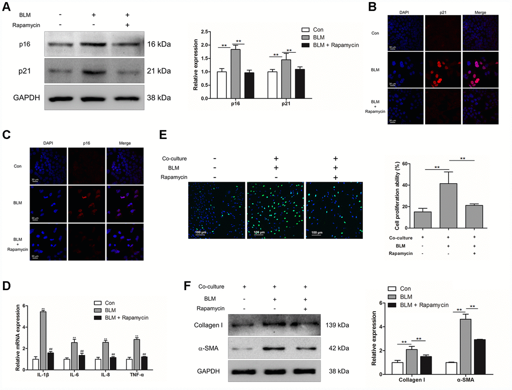 Rapamycin could suppress epithelial cell senescence and fibroblast activation via impairing the production of SASP. (A–E) MLE-12 cells were treated with bleomycin (BLM), followed by treatment with or without rapamycin for 3 days. (A) The expression of p16 and p21 were measured by Western blot. The expression levels were quantified with ImageJ (n = 3). GAPDH was used as a loading control, **P B, C) The protein levels of p16 and p21 were detected by immunofluorescence. (D) The mRNA levels of IL-1β, IL-6, IL-8 and TNF-α were determined by Q-PCR, ** P E, F) MLE-12 cells were treated as in Figure 4A and co-cultured with pulmonary fibroblasts in fresh medium for another 3 days. (E) The proliferation ability of pulmonary fibroblasts were measured by EdU assay. The percentage of proliferating cells was calculated by ImageJ, **P F) The expression of α-SMA and collagen I were detected by Western blot. The expression levels were quantified with ImageJ (n = 3). GAPDH was used as a loading control, **P 