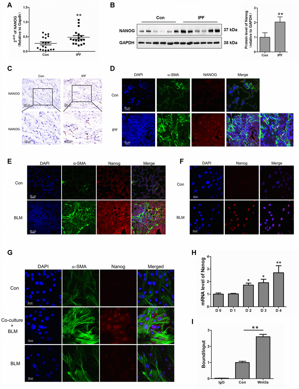 Aberrantly expressed Nanog in activated pulmonary fibroblasts and fibrotic lung tissues were mediated by Wnt/β-catenin. (A–C) The expression of Nanog in lung tissues derived from patients with idiopathic pulmonary fibrosis (IPF) was determined by Q-PCR (A), Western blot (B) and immunohistochemical analysis (C), ** P D) The lung tissues of patients with IPF were double stained with α-SMA and Nanog by immunofluorescence. (E) The lung tissues derived from pulmonary fibrosis mouse models were double stained with α-SMA and Nanog via immunofluorescence. (F) The expression of Nanog in pulmonary fibroblasts isolated from fibrotic mouse lung tissues were measured by immunofluorescence. (G) Cells were treated as in Figure 3D. Pulmonary fibroblasts were double stained with α-SMA and Nanog by immunofluorescence. (H, I) Pulmonary fibroblasts were treated with Wnt3a for various durations. (H) The mRNA level of Nanog was detected by Q-PCR, * P I) ChIP assays were performed by using chromatin isolated from Wnt3a treated pulmonary fibroblasts. The final DNA extracts were analysed by Q-PCR, ** P 