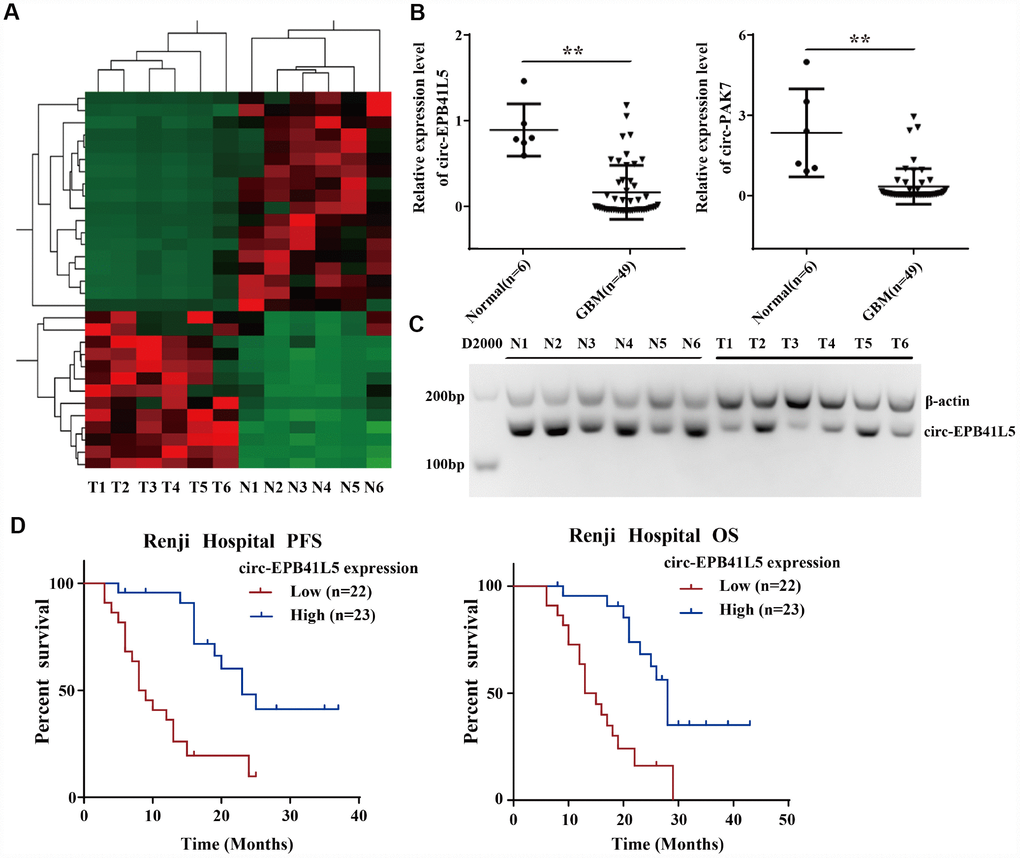 Profile of circRNAs in human glioblastoma samples and circ-EPB41L5 characterization. (A) Hierarchical cluster analysis of RNA-seq data was used to present the significantly dysregulated circRNAs between a normal brain and glioblastoma tissues. Red represents high expression, and green represents low expression. (FC≥2.0, PB) circ-EPB41L5 and circ-PAK7 were downregulated in glioblastoma detected by qRT-PCR (49 Glioblastoma and 6 normal). (C) RT-PCR gels showed that circ-EPB41L5 were downregulated in glioblastoma. (D) Prognostic significance of circ-EPB41L5 expression for glioblastoma patients. The expression median value was used as the cutoff. *PP