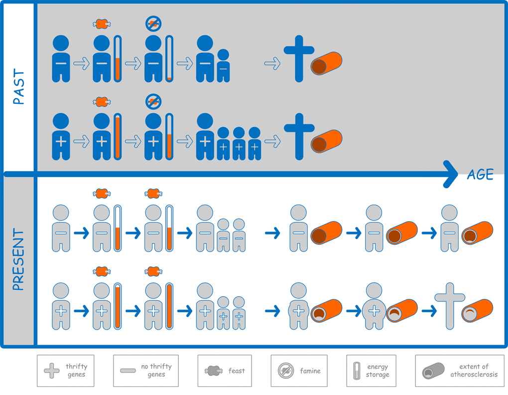 “+” denotes the presence of so-called thrifty genes like those leading to hypercholesterolemia, “–“ denotes the absence of these genes. In the past (upper panel), carriers of thrifty genes were able to build comparably larger amounts of energy storage (orange bars) after feast episodes. In famine episodes, carriers of thrifty genes were therefore more likely to reproduce. Usually, people died before the negative consequences of metabolic profiles associated with thrifty genes became relevant. In contrast, today (lower panel), in the absence of famines, thrifty genes do not become relevant with respect to reproduction, but lead to traits of the metabolic syndrome, atherosclerosis, and earlier death due to atherosclerotic cardiovascular disease as the most common cause of death in Western societies.