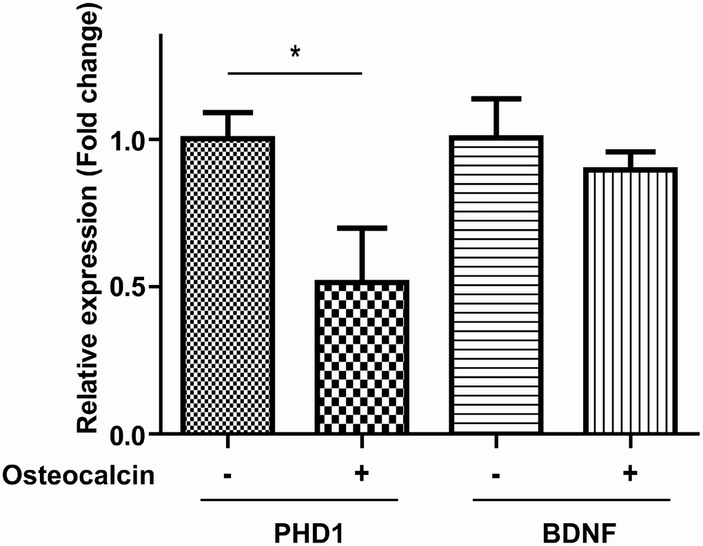 RT-PCR experiment. The mRNA expression of PHD1 in the OGD/R model was significantly decreased by the addition of osteocalcin (10 ng/ml) (*, P