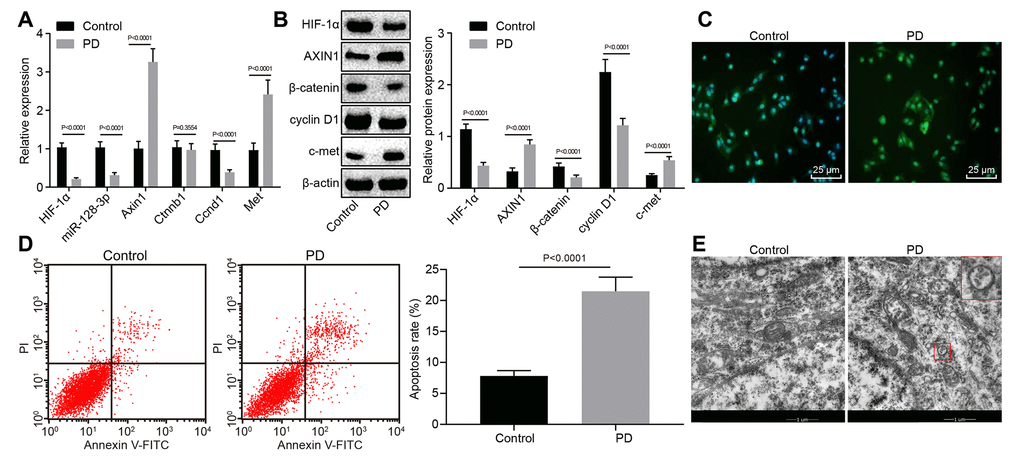 The expression pattern of HIF-1α/miR-128-3p/AXIN1 and the Wnt/β-catenin signaling pathway-related proteins (β-catenin, cyclin D1 and c-met) in hippocampal neurons of normal mice (n = 10) and the MPTP-lesioned mouse model of PD (n = 30). (A) The miR-128-3p expression and mRNA levels of Hif1a, Axin1, Ctnnb1, Ccnd1, and Met determined by RT-qPCR. (B) The protein levels of HIF-1α, AXIN1, β-catenin, cyclin D1, and c-met normalized to β-actin as determined by western blot analysis. (C) The localization of β-catenin protein in hippocampal tissues detected by the immunofluorescence assay (scale bar = 25 μm). (D) The hippocampal neuron apoptosis identified by flow cytometry. (E) The ultrastructure of hippocampal neurons through electron microscopy. * p vs. the control group (primary hippocampal neurons of normal mice).