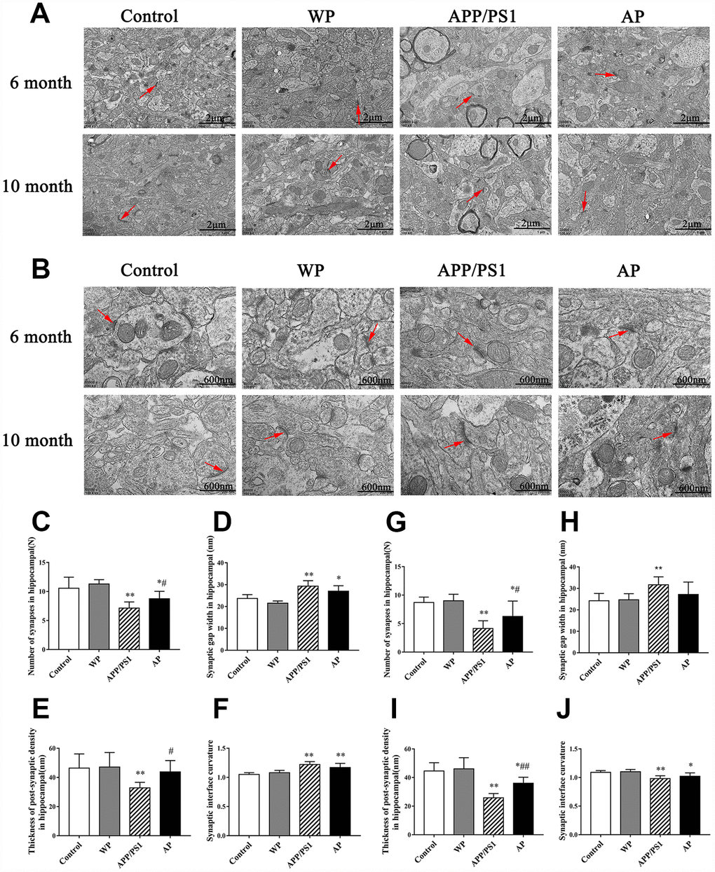 Activation of α7 nAChR increases the number of synapses and maintains the structural integrity of synapses in the hippocampus of APP/PS1