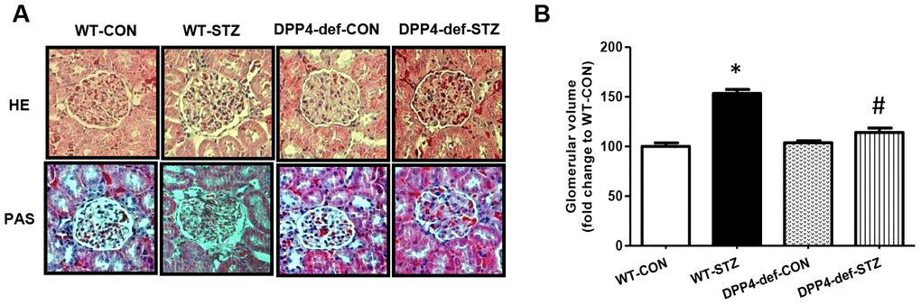 DPP4 deficiency recovers the structure of glomerulus impaired by STZ. Kidney samples were collected at 42 days, since over 300 mg/dL of blood glucose after STZ injection as described in the Materials and Methods. The glomerular volume was measured using the ImageJ software for at least 15 images from each kidney section. (A) Representative image of glomerulus by H&E staining and by PAS staining, (B) Glomerular volume. WT-CON: wild-type control, WT-STZ: wild-type-STZ, DPP4-def-CON: DPP4-deficient control, DPP4-def-STZ: DPP4-deficient-STZ. Data are shown as the means ± SEM. *p#p 
