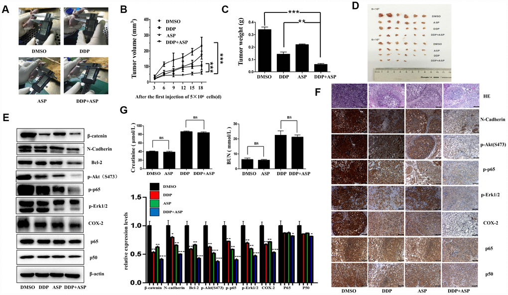 Aspirin synergizes the inhibiting effect of Cisplatin on tumor growth in a xenograft mouse model of human colon cancer cells. Human colon cancer LoVo cells (5×106, 5×105 in 100 ul PBS) were injected subcutaneously into the left and right flank of each athymic nude mice respectively. The four randomly assigned groups (n=6 for each group) were used: (1) non-drug therapy as negative control; (2) the treatment with Cisplatin (3 mg/kg) through intraperitoneal injection every three days; (3) a daily treatment of Aspirin(100 mg/kg) through intragastric administration; (4) the combination therapy of Cisplatin and Aspirin. (A) The representative images of the measurement of tumor diameters. (B) Dynamic development of tumor volume during the therapy. (C) Tumor weight of nude mice from each group at the moment when mice were sacrificed. (D) Images of xenograft tumor harvested after therapy. (E) The expression levels of β-catenin, N-Cadherin, Bcl-2, p-Akt(S473), p-p65, p-Erk1/2, COX-2, p65 and p50 in tumor tissue lysates were detected by western blot assay (n=6). (F) HE staining and immunohistochemical staining assay to show tissue morphological variations and the expressions of N-Cadherin, p-Akt(S473), p-p65, p-Erk1/2, COX-2, p65 and p50 in tissue sections. The representative images were taken by upright microscope. Scale bars, 100 μm (n=6). (G) Serum creatinine (Cr) and Blood Urea Nitrogen (BUN) levels of mice in each group were measured by the detection kit (n=6). Data were presented as means ± SD, *P