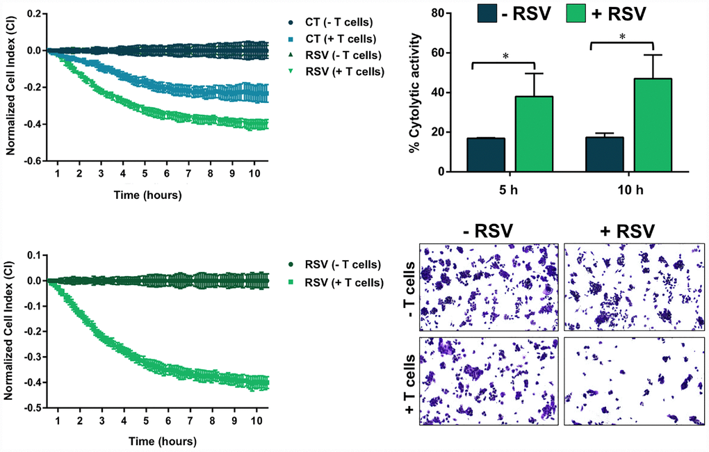 Resveratrol enhances the susceptibility to T-cell-mediated tumor cell killing. T-cell-mediated cell death of JIMT-1 cells pre-cultured in the absence of presence of RSV was measured using the xCELLigence system. Shown are the mean (±SD, n=3) of % lysis values calculated from the impedance-based lysis assay at 5 and 10 hours following the addition of T-cells. Also shown are microphotographs of representative T-cell-mediated cancer cell killing assays in which tumor cells were subjected to crystal violet staining. Statistical analysis was performed using GraphPad Prism 7, using two-way ANOVA with Sidak’s multiple comparison post-test, comparing untreated versus RSV-treated per time (* = P 