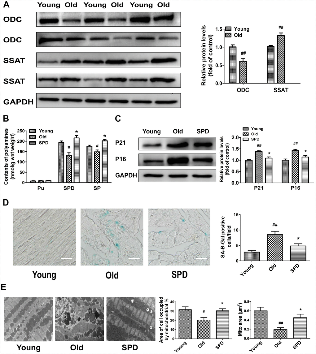 Age-dependent changes in polyamine metabolism and effect of spermidine on cardiac aging in rats. (A) Representative immunoblot bands for ODC and SSAT and quantification of protein levels in the myocardium of 3-month-old (Young) and 24-month-old (Old) rats. GAPDH was used as loading control. (B) Polyamine content, including putrescine (PU), spermidine (SPD), and spermine (SP) in the myocardium of young, old, and SPD-treated old rats (SPD group) evaluated by high-performance liquid chromatography. (C) Representative immunoblot bands for p21 and p16 and quantification of protein levels. GAPDH was used as loading control. (D) Positive area of senescence-associated β-galactosidase (SA-β-gal) staining. Scale bars: 20 μm. (E) Representative transmission electron microscopy images showing ultrastructural changes in the myocardia. Quantification of the area of cells occupied by mitochondria (%); Magnification: ×10,000. n = 6 for each group. # P ## P * P 