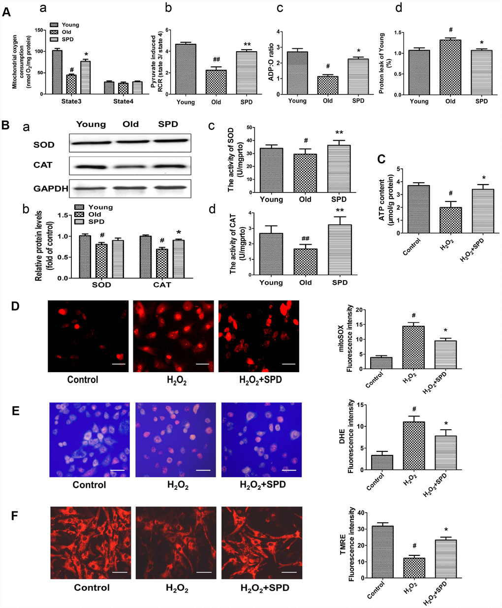Effect of SPD on mitochondrial respiration and ROS accumulation in the aged heart and in H2O2-treated cardiomyocytes. (A) Mitochondrial oxidative phosphorylation (OXPHOS) efficiency was evaluated in the rat myocardium. Measurements included mitochondrial oxygen consumption States 3 and 4 (a), respiratory control rate (RCR) (b), P/O ratio (c), and proton leakage (d). Respiration was induced with pyruvate/malate (5 mM each) as energizing substrates and ADP (200 μM) to initiate State 3 respiration (n = 8). (B) Western blot analysis of SOD and CAT expression (a, b), and colorimetric detection SOD and CAT activity (c, d). n = 4 for protein expression and n = 8 for activity assay. # P ## P * P ** P C) ATP content of cardiomyocytes measured by luminometry in NRCMs (n = 8). (D) Superoxide production in mitochondria detected by MitoSOX staining in H9C2 cells. (E) ROS production in H9C2 cells detected by DHE in H9C2 cells. (F) Mitochondrial transmembrane potential (ΔΨm) detected by TMRE in H9C2 cells. Quantification of the mean fluorescence intensity of MitoSOX, DHE, and TMRE are displayed on the right side of the graphs (n = 8). # P ## P * P 2O2 group, ** P 2O2 group.