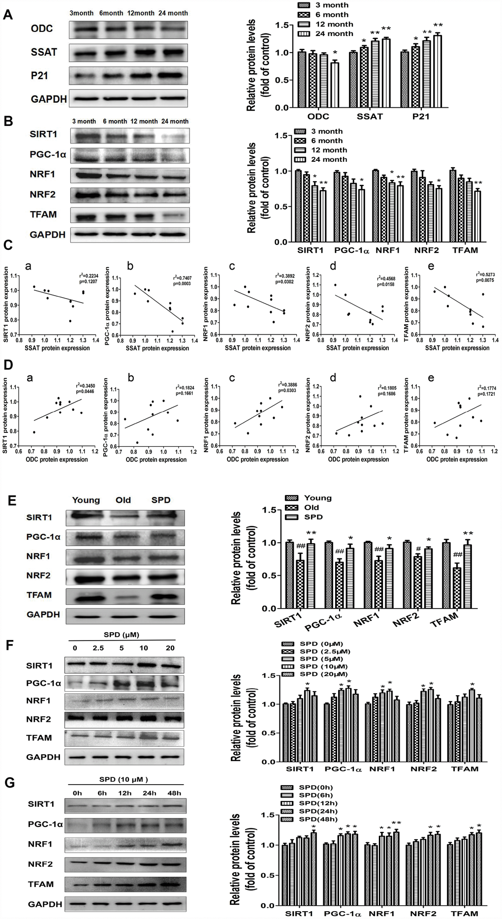 SPD prevents age-associated depletion in myocardial polyamines and alterations of SIRT1/PGC-1α signaling pathway proteins. Representative immunoblot bands for ODC, SSAT, and p21 (A), and for SIRT1, PGC-1α, NRF1, NRF2, and TFAM (B) in myocardium from 3-, 6-, 12- and 24-month-old rats. GAPDH was used as loading control. (n = 10). * P ** P C) Correlation between ODC and (a) SIRT1, (b) PGC-1α, (c) NRF1, (d) NRF2, and (e) TFAM in cardiac tissue from rats of different ages. (D) Correlation between SSAT and (a) SIRT1, (b) PGC-1α, (c) NRF1, (d) NRF2, and (e) TFAM in cardiac tissue from rats of different ages (n = 10). (E) Representative immunoblot bands for SIRT1, PGC-1α, NRF1, NRF2, and TFAM in the myocardium of young (3 months of age), old (24 months of age), and SPD-treated (6 weeks) old rats. (n = 4). # P ## P * P ** P F, G) Expression of SIRT1, PGC-1α, NRF1, NRF2, and TFAM measured by western blot in NRMCs treated with 0, 2.5, 5, 10, or 20 μM SPD for 24 h (F) or 10 μM SPD for 0, 6, 12, 24, and 48 h (G). Quantification of protein expression is shown on the right-hand side of the graphs (n = 4). * P ** P 
