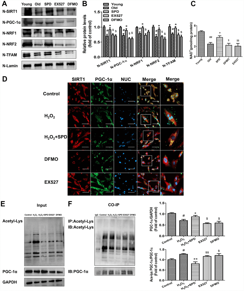 SIRT1 is required for SPD-induced PGC-1α activation in aging cardiomyocytes. (A) Western blot detection of SIRT1, PGC-1α, NRF1, NRF2, and TFAM in nuclear fractions isolated from cardiac tissue. (B) Quantification of protein expression based on L-lamin as a nuclear loading control (n = 4). (C) Quantification of NAD+ levels by fluorimetry (n = 8). # P ## P * P ** P $ P $$ P D) Co-localization of SIRT1 (red) and PGC-1α (green) by immunofluorescence in H9C2 cells. Nuclei were stained with DAPI (blue) (n = 8); scale bars: 20 μm. (E, F) Western blot and immunoprecipitation (IP) analysis of PGC-1α acetylation status in NRCMs. Quantification is shown on the right-hand side of the graphs. GAPDH was used as loading control (n = 4). # P ## P * P 2O2, ** P 2O2, $ P 2O2 + SPD, $$ P 2O2 + SPD.