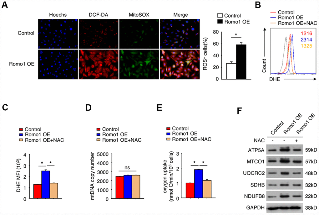 The overexpression of Romo1 promoted the accumulation of ROS and results in mitochondrial dysfunction in macrophages. (A) The control and the Romo1-overexpressed macrophages were analyzed by immunofluorescence with DCF-DA and MitoSOX staining to detect the levels of cytoplasmic and mitochondrial ROS. The ROS+ cells were counted under microscopy and statistically analyzed. (B) The levels of DHE in control and Romo1-overexpressed macrophages (with or without treatment of 5mM NAC) were analyzed by flow cytometry. (C) The mean fluorescence intensity (MFI) of DHE in flow cytometry was respectively quantified and statistically analyzed. (D) The statistical analysis of the mtDNA copy number in control and Romo1-overexpressed (with or without treatment of 5mM NAC) macrophages. (E) The statistical analysis of the oxygen uptake rate in control and Romo1-overexpressed (with or without treatment of 5mM NAC) macrophages. (F) The expression of the indicated proteins was examined by western blotting in control and Romo1-overexpressed (with or without treatment of 5mM NAC) macrophages. Data are representative of at least three independent experiments and are presented as mean ± SD. ns, not significant; *, P 