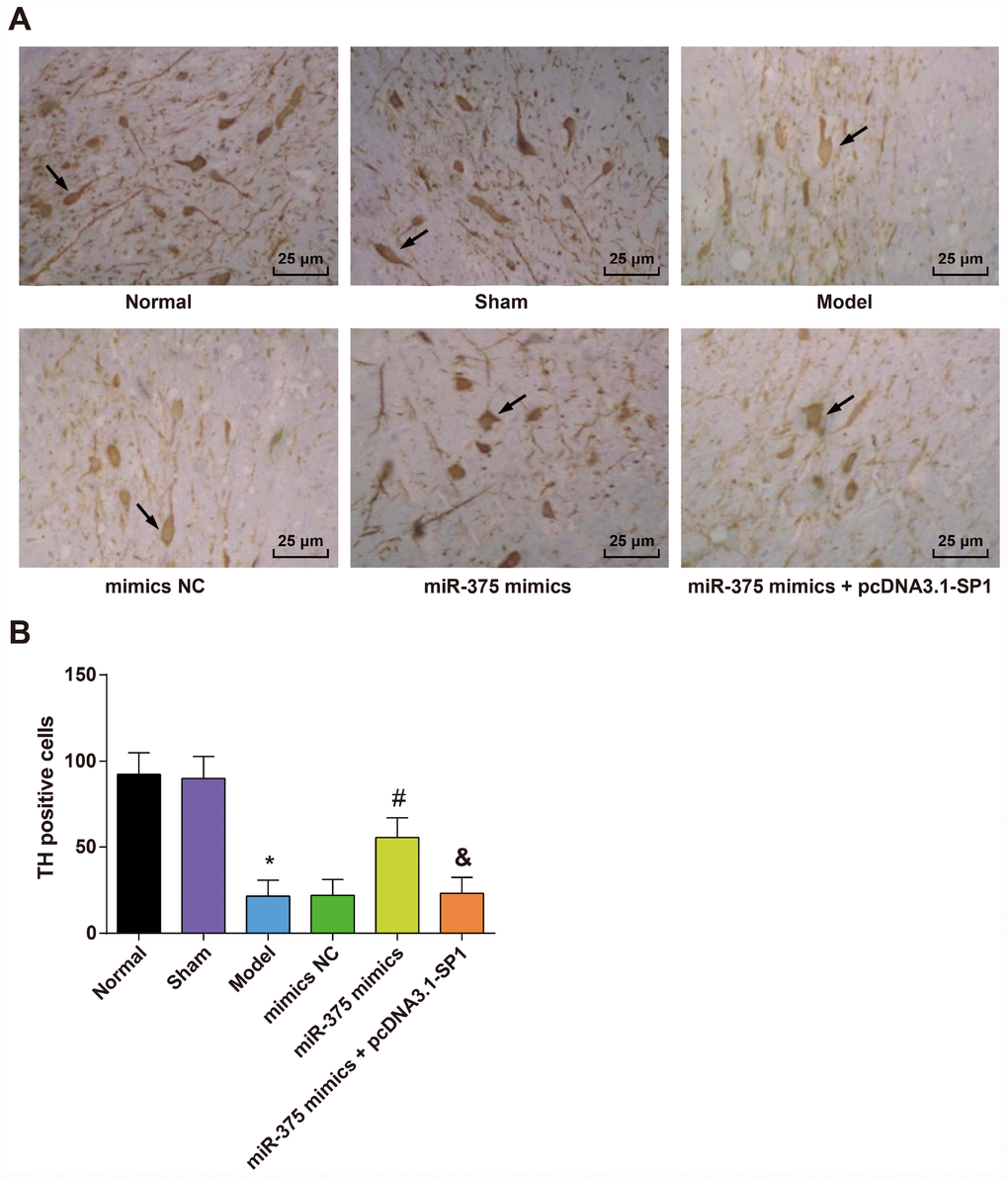 Expression of TH positive neurons in the substantia nigra of rats in each group (n = 12). (A) Immunohistochemical staining of TH in substantia nigra of rats in each group (× 400, the arrow indicates the TH positive neurons); (B) Number of TH positive cells in substantia nigra of rats in each group; * P P P 