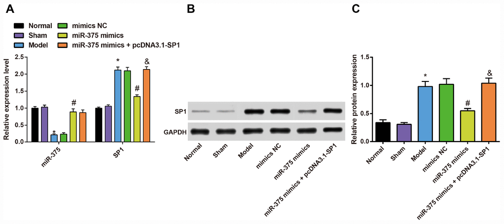 Expression of miR-375 and SP1 in the substantia nigra of rats in each group (n = 12). (A) Expression of miR-375 and SP1 mRNA in the substantia nigra of rats in each group; (B, C) Expression of SP1 protein in the substantia nigra of rats in each group; * P P P 