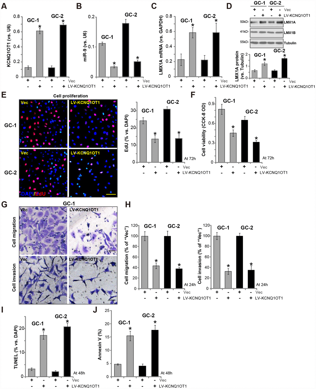 Forced overexpression of LncRNAKCNQ1OT1 induces miR-9 reduction and LMX1A upregulation in primary human GC cells. The primary human GC cells (“GC-1/GC-2”) were infected with LncRNAKCNQ1OT1-expressing lentivirus (“LV-KCNQ1OT1”) or scramble control vector lentivirus (“Vec”) for 72h, expression of KCNQ1OT1 (A), miR-9 (B) and LMX1A mRNA (C) were tested by qPCR assay; LMX1A and LMX1B protein expression in total cell lysates was tested by Western blotting assay (D, LMX1A protein results were quantified); Cells were further cultured for the indicated time periods, cell proliferation and viability were tested by EdU staining assay (E) and CCK-8 (F), respectively, with cell migration and invasion tested by “Transwell” and “Matrigel Transwell” assay (G and H); Cell apoptosis was quantified via the TUNEL staining assay (I) and Annexin V-FACS assay (J). For each assay, n=5. *P vs. “Vec” cells. Experiments in this figure were repeated three times, and similar results were obtained. Bar=100 μm (E and G).