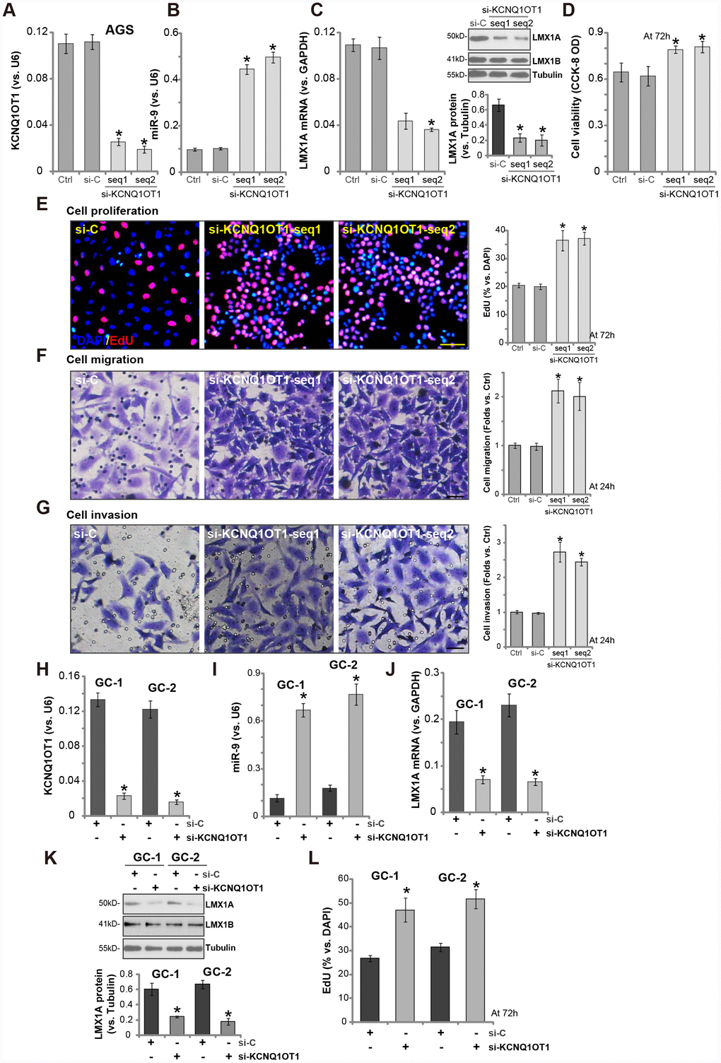 LncRNA KCNQ1OT1 siRNA induces miR-9 upregulation and LMX1A downregulation, promoting GC cell progression in vitro. AGS cells (A–G) or primary human GC cells (“GC-1/GC-2”) (H–L) were transfected with 500 nM of KCNQ1OT1 siRNA (“seq1/seq2”, two rounds, total 48h) or the scramble control siRNA (“si-C”, two rounds, total 48h), expression of KCNQ1OT1 (A and H), miR-9 (B and I) and LMX1A mRNA (C and J) were tested by qPCR assays; LMX1A and LMX1B protein expression was tested by Western blotting assay (C and K, LMX1A protein results were quantified); Cells were further cultured for the indicated time periods, cell viability (D) and proliferation (E and L) were tested by the listed assays; Cell migration and invasion were tested by “Transwell” (F) and “Matrigel Transwell” (G) assays respectively. For each assay, n=5. *P vs. “si-C” cells. Experiments in this figure were repeated three times, and similar results were obtained. Bar=100 μm (E–G).