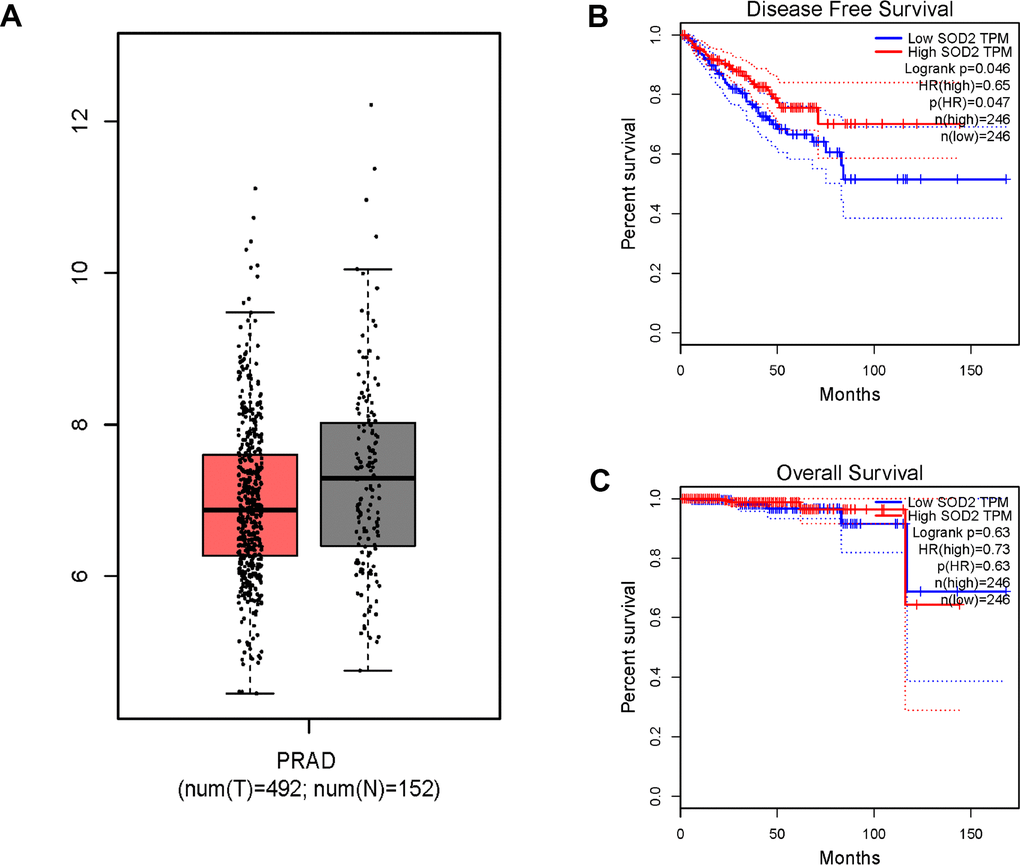 In silico analysis of SOD2 expression in prostate cancer patients (A), the investigation of disease-free survival (DFS) time (B) and overall survival (OS) time (C). Expression of SOD2 was down-regulated in prostate cancer tissues (Figure 6A, P Figure 6B, P = 0.047). No positive association was indicated for prostate cancer participants (Figure 6C, P = 0.630).