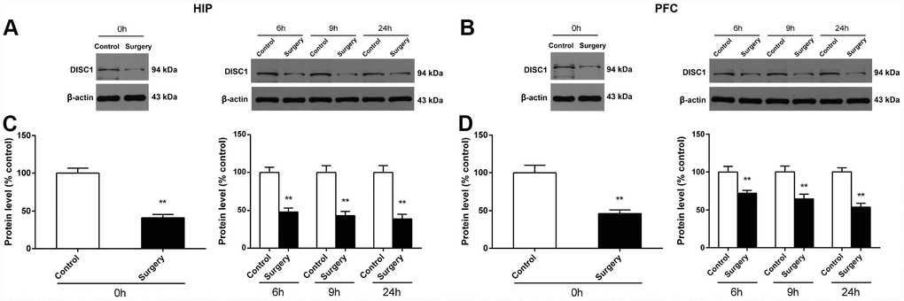 Surgery/Anesthesia decreased the DISC1 expression in the hippocampus and prefrontal cortex of aged mice at postoperative 0, 6, 9, and 24 hours. The expression of DISC1 was estimated using western blotting analysis of fresh homogenates from hippocampal and prefrontal cortex tissues of mice at 0, 6, 9, and 24 hours after Surgery/Anesthesia or control treatment. (A and C) The level of DISC1 in the hippocampus of mice in the Surgery/Anesthesia group decreased significantly compared to that in control mice at postoperative 0, 6, 9, and 24 hours. (B and D) The level of DISC1 in the prefrontal cortex tissue of mice in the Surgery/Anesthesia group decreased significantly compared to that in control mice at postoperative 0, 6, 9, and 24 hours. The data are plotted as the mean ± standard error of the mean for each group (n = 6). *p **p 