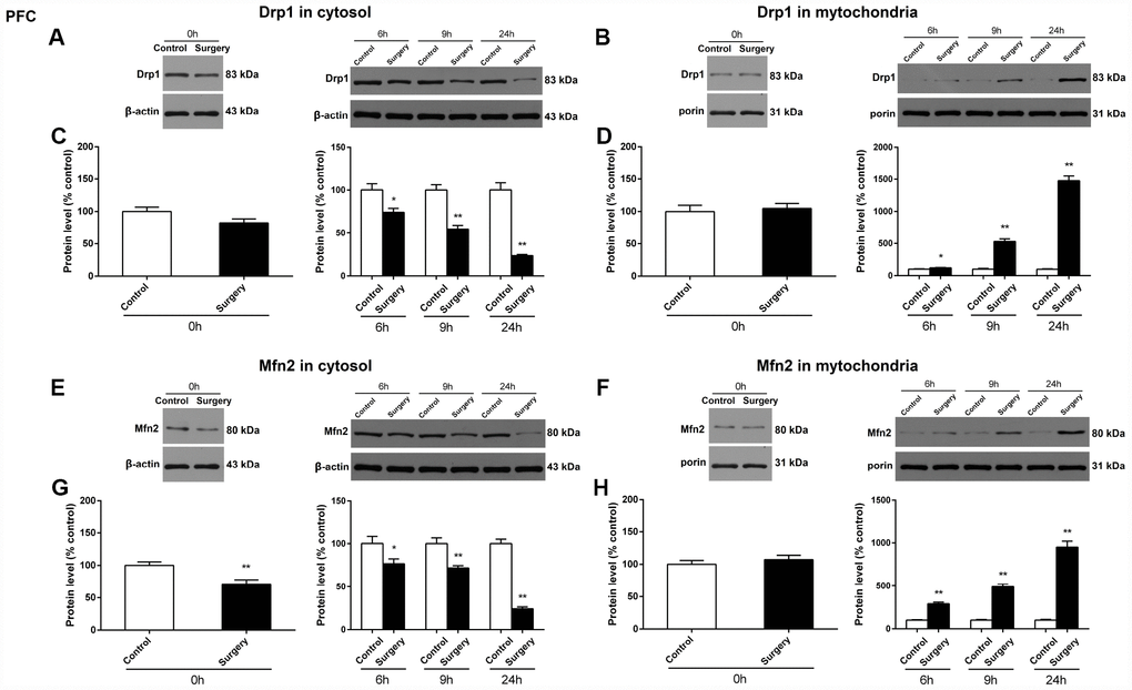 Surgery/Anesthesia changed the expression of Drp1 and Mfn2 in the cytosolic fraction and in the mitochondrial fraction of the prefrontal cortex tissues in aged mice at postoperative 0, 6, 9, and 24 hours. Immediately after Surgery/Anesthesia, there was no significant change in the expression of Drp1 both in the cytosolic fraction (A and C) and the mitochondrial fraction (B and D) as compared to that in the control condition. At 6, 9, and 24 hours postoperatively, Surgery/Anesthesia significantly decreased the expression of Drp1 in the cytosolic fraction (A and C) and increased Drp1 protein level in the mitochondrial fraction (B and D) from the prefrontal cortex tissues in mice when compared to the control condition. Additionally, Surgery/Anesthesia decreased the expression of Mfn2 in the cytosolic fraction (E and G) at 0, 6, 9, and 24 hours postoperatively. When compared to the control condition, Surgery/Anesthesia did not significantly change the expression of Mfn2 in the mitochondrial fraction (F and H) at 0 hour postoperatively. As compared to the control condition, Surgery/Anesthesia significantly increased Mfn2 expression in the mitochondrial fraction (F and H) from the prefrontal cortex tissue in mice at 6, 9, and 24 hours postoperatively. The data are plotted as the mean ± standard error of the mean for each group (n = 6). *p **p 