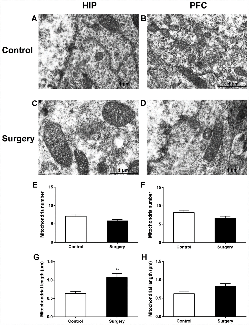 Surgery/Anesthesia caused acute ultrastructural changes in the mitochondria of hippocampal but not prefrontal cortex neurons in aged mice immediately after Surgery/Anesthesia. Mitochondria in the cytoplasm of hippocampal (A) and prefrontal cortex (B) neurons from the control mice resemble long tubules with intact outer and inner membranes and numerous cristae tightly packed in healthy looking matrix. Compared with those in the control group, mitochondria in the cytoplasm of hippocampal neurons (C) from mice in the Surgery/Anesthesia group became swollen, while the ultrastructure of mitochondria in the prefrontal cortex neurons (D) was normal immediately after Surgery/Anesthesia. The number and length of mitochondria were measured in the hippocampus (E, G) and prefrontal cortex (F, H) in 6 different fields of view per animal. (G) Surgery/Anesthesia increased mitochondrial length in the hippocampus compared to the control condition at 0 hour postoperatively. Scale bar: 1 μm. The data are plotted as the mean ± standard error of the mean for each group (n = 3). **p 