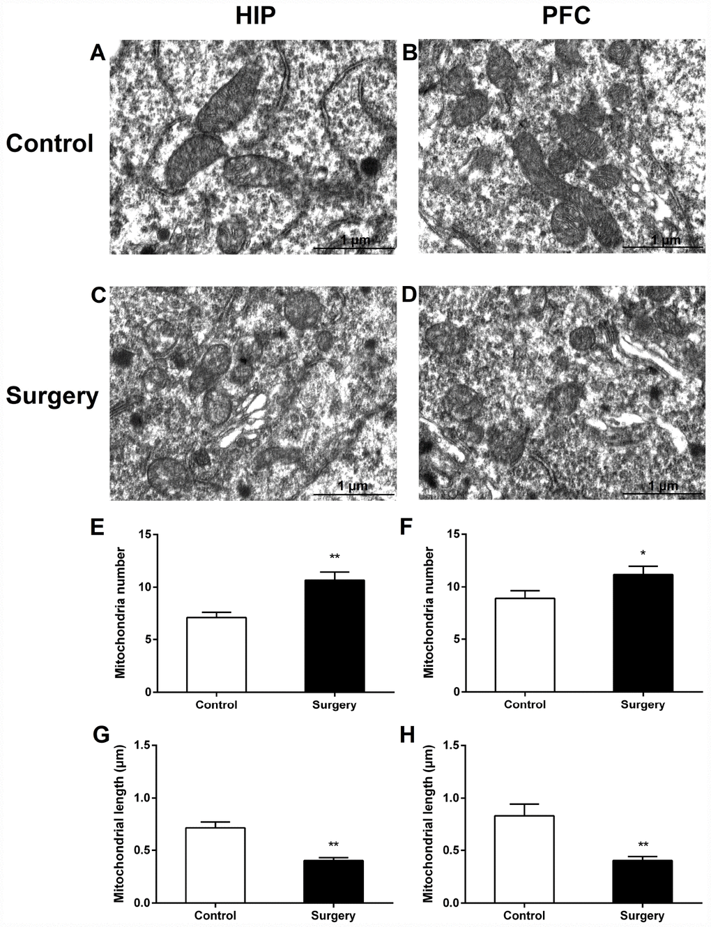 Surgery/Anesthesia caused ultrastructural changes in the mitochondria of hippocampal and prefrontal cortex neurons in aged mice at 24 hours postoperatively. Mitochondria in the cytoplasm of hippocampal (A) and prefrontal cortex (B) neurons from the control mice resemble long tubules with intact outer and inner membranes and numerous cristae tightly packed in healthy looking matrix. The number of mitochondria in the cytoplasm of hippocampal (C and E) and prefrontal cortex (D and F) neurons from mice in the Surgery/Anesthesia group were increased significantly. Compared to the control condition, Surgery/ Anesthesia decreased the mitochondrial length in the hippocampus (G) and prefrontal cortex (H) at 24 hours postoperatively. The mitochondria in the Surgery/Anesthesia group were small, round, and displayed globular morphology. Although the outer and inner membranes appeared somewhat intact, the cristae seemed distorted and difficult to discern. Scale bar: 1 μm. The data are plotted as the mean ± standard error of the mean for each group (n = 3). *p **p 