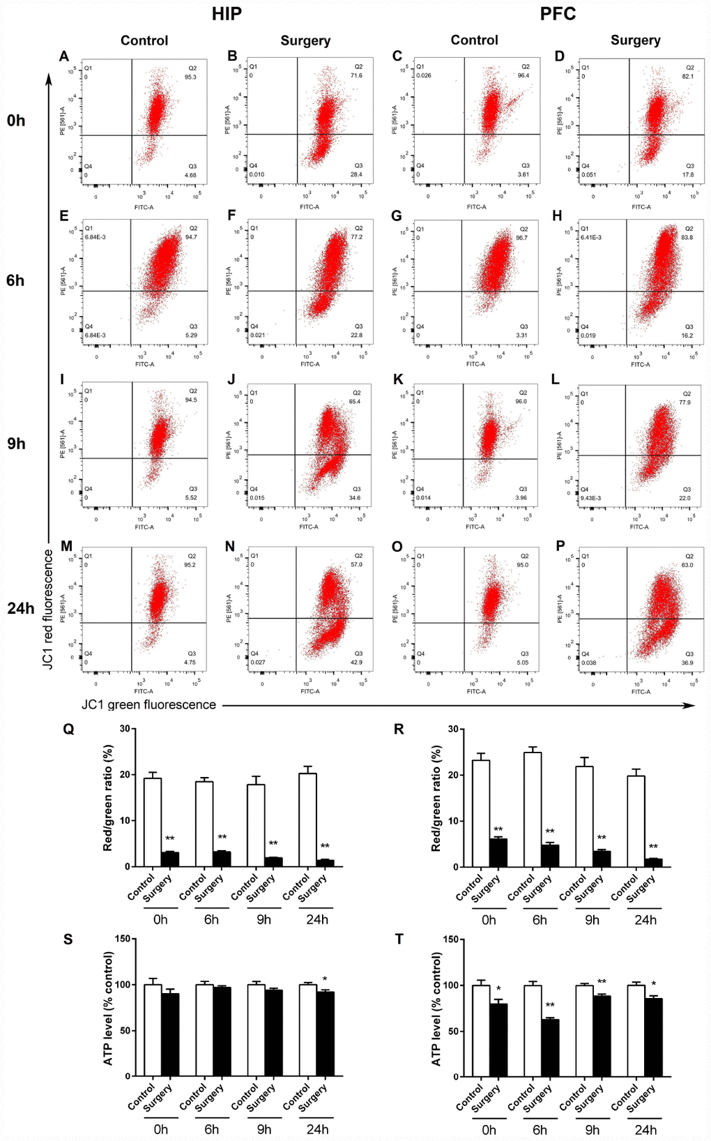 Surgery/Anesthesia altered the levels of MMP and ATP in the hippocampus and prefrontal cortex of aged mice at 0, 6, 9, and 24 hours postoperatively. Changes in MMP were measured using flow cytometry and JC-1. Representative graphs of flow cytometric analysis of the altered MMP level in the hippocampus (A, B, E, F, I, J, M, N) and prefrontal cortex (C, D, G, H, K, L, O, P) of mice after incubation with JC-1. Statistical bar graphs show the changes of MMP detected using flow cytometry. The changes of MMP in the hippocampal (Q) and prefrontal cortex tissues (R) were defined as the ratio of red/green fluorescence intensity. Surgery/Anesthesia reduced the MMP level in the hippocampus and prefrontal cortex as compared to the control condition in mice immediately after Surgery/ Anesthesia. (S) Surgery/Anesthesia decreased the ATP level in the hippocampus at 24 hours but not at 0, 6, or 9 hours postoperatively. (T) In the prefrontal cortex, Surgery/Anesthesia significantly decreased the level of ATP as compared to control condition in mice at all the postoperative timepoints. The data are plotted as the mean ± standard error of the mean for each group (n = 6). *p **p 