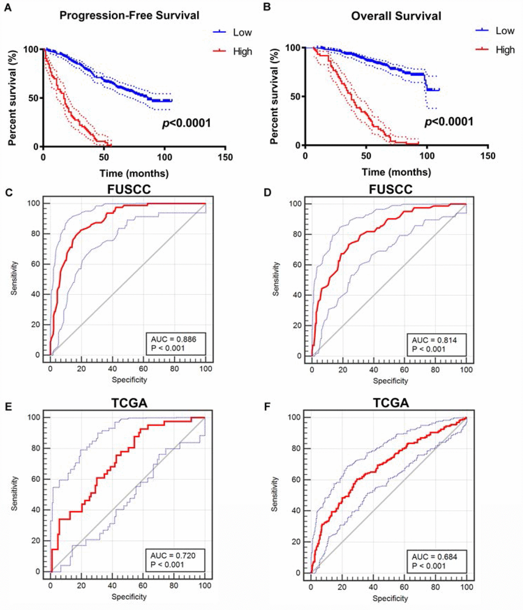 Construction and internal validation of integrated prognostic and diagnostic model. All significant clinicopathologic parameters and gene expression profiles was integrated in the Cox regression models, which indicated this formula: = -0.708×CDH1 expression (ref. Low) + 1.360×SNAI1 expression (ref. Low) + 1.905×VIM expression (ref. Low) + 2.179×TWIST1 expression (ref. Low) + 1.274×T stage (ref. T1-T2) + 1.919×M stage (ref. M0) + 2.021×AJCC stage (ref. I-II) + 2.013×ISUP grade (ref. 1-2) for PFS (A), and another formula: = -0.564×CDH1 expression (ref. Low) + 1.532×SNAI1 expression (ref. Low) + 1.804×VIM expression (ref. Low) + 1.714×TWIST1 expression (ref. Low) + 1.226×T stage (ref. T1-T2) + 1.778×M stage (ref. M0) + 2.515×AJCC stage (ref. I-II) + 1.954×ISUP grade (ref. 1-2) for OS (B). The Kaplan–Meier method was used to determine the significant survival outcomes (PFS: pC) and 0.814 for OS (pD). (E, F) External validation of integrated model using TCGA cohorts. ROC curves were constructed to perform external validation using clinicopathological parameters and mRNA expression profiles from TCGA cohort. The AUC index for the integrated model were 0.720 for PFS (pE) and 0.684 for OS (pF).