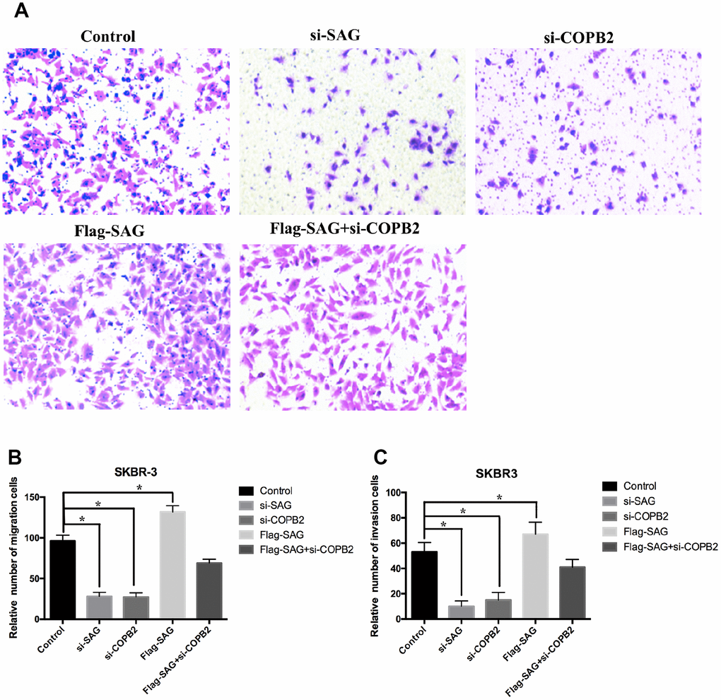 Downregulation of SAG or COPB2 inhibited breast cancer cell migration and invasion. (A) Representative images of migrated cells following transfection with the indicated genes. (B) Columns representing the relative number of migrated cells in the different groups. (C) Columns representing the relative number of invading cells in the different groups. (*P 