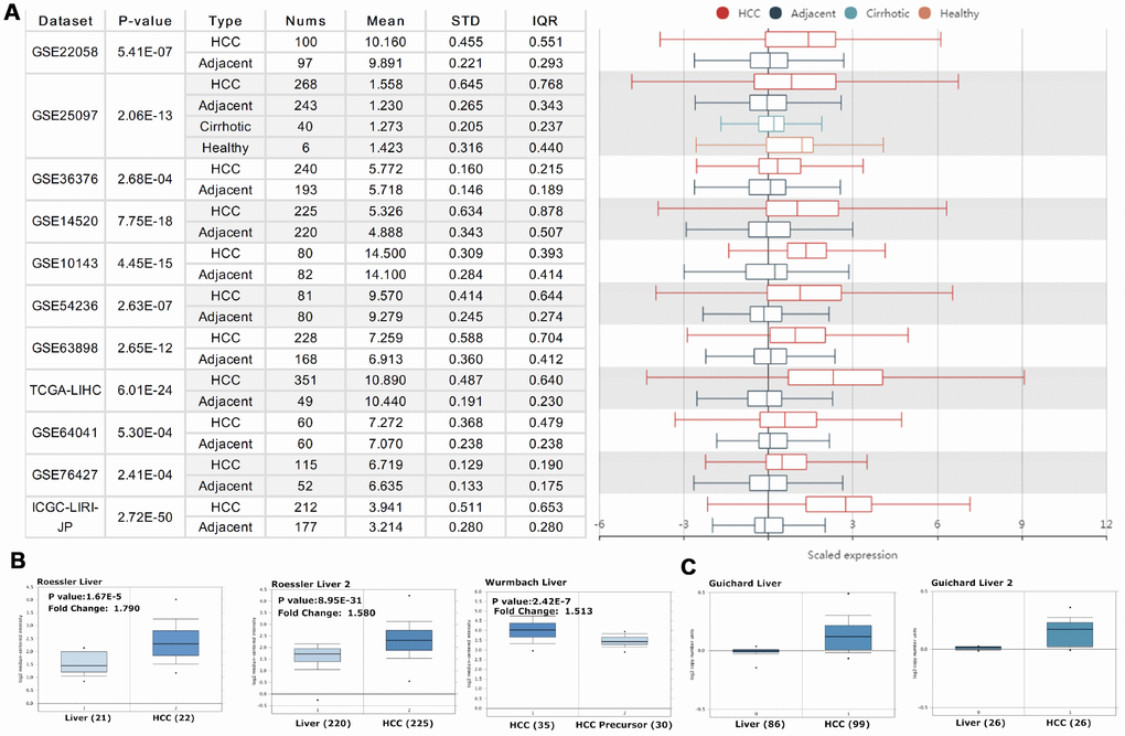 PRPF3 transcription level in HCC. (A) Chart and plot showing the expression of PRPF3 in tumor tissues and the adjacent normal tissues, according to t-test in HCCDB. (B) Box plot showing PRPF3 mRNA levels in the Roessler Liver, Roessler Liver 2, and Wurmbach Liver datasets, respectively. (C) Box plot showing PRPF3 copy number in Guichard Liver and Guichard Liver 2 datasets, respectively.