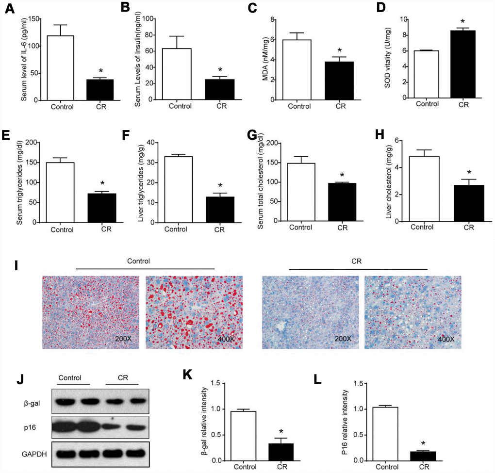 40% CR for 6 months (14 to 20 months old) delays age-related alterations in aging liver. Levels of (A) IL-6 and (B) insulin in serum were measured by ELISA. Levels of (C) MDA, (D) SOD, (E) serum TG, (F) liver TG, (G) serum TC, and (H) liver TC were measured using commercial kits. (I) Lipid droplet accumulation was assessed via Oil Red O staining. (J) Western blotting was used to determine levels of senescence markers (K) β-gal and (L) p16. Results are shown as the mean ± SD of eight animals per group. *p 