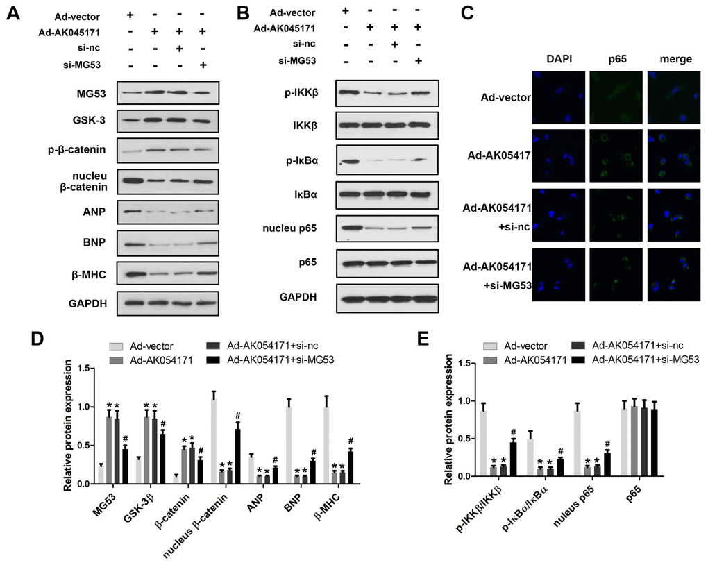 AK045171 is involved in the regulation of MG53/GSK3/β-catenin and MG53/NFκB pathways. Western blotting was used to evaluate the expression levels of proteins in the MG53/GSK3/β-catenin (A, B) and MG53/NFκB (C, D) pathways. (E) Immunofluorescence staining of p65 was performed to observe nuclear transfer of p65. * p