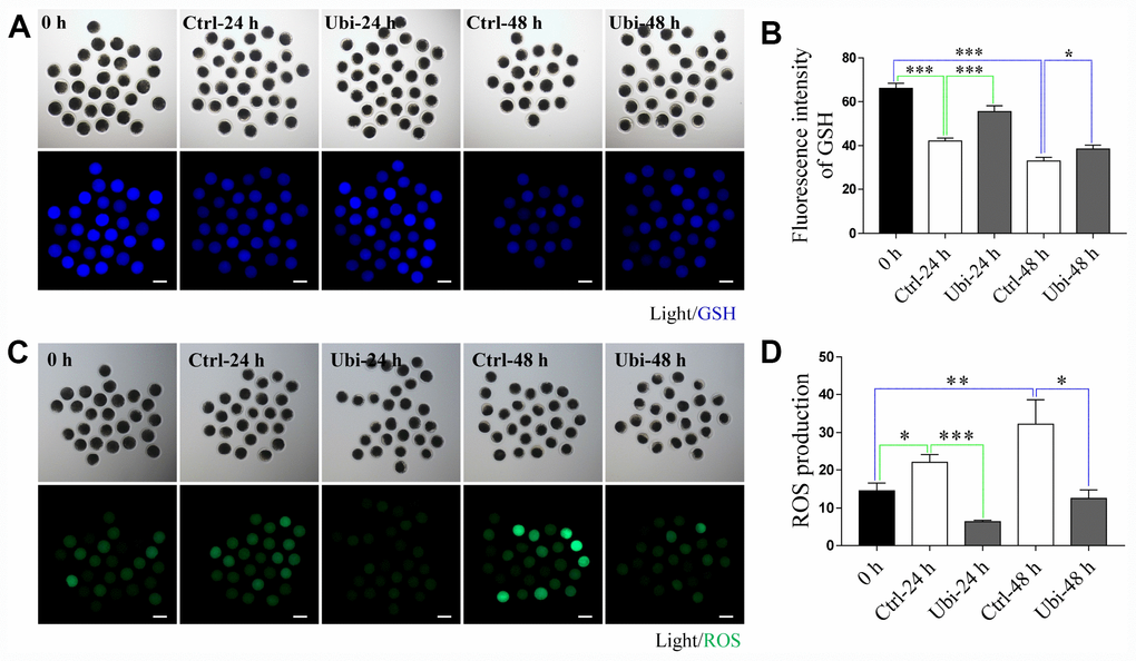 Ubiquinol-10 rescued aging-induced oxidative stress. Images (A) and GSH level (B) in 0 h, Ctrl-24 h, Ubi-24 h, Ctrl-48 h, and Ubi-48 h oocytes. Scale bars indicate 100 μm. Images (C) and ROS level (D) in 0 h, Ctrl-24 h, Ubi-24 h, Ctrl-48 h, and Ubi-48 h oocytes. Scale bars indicate 100 μm. *p 