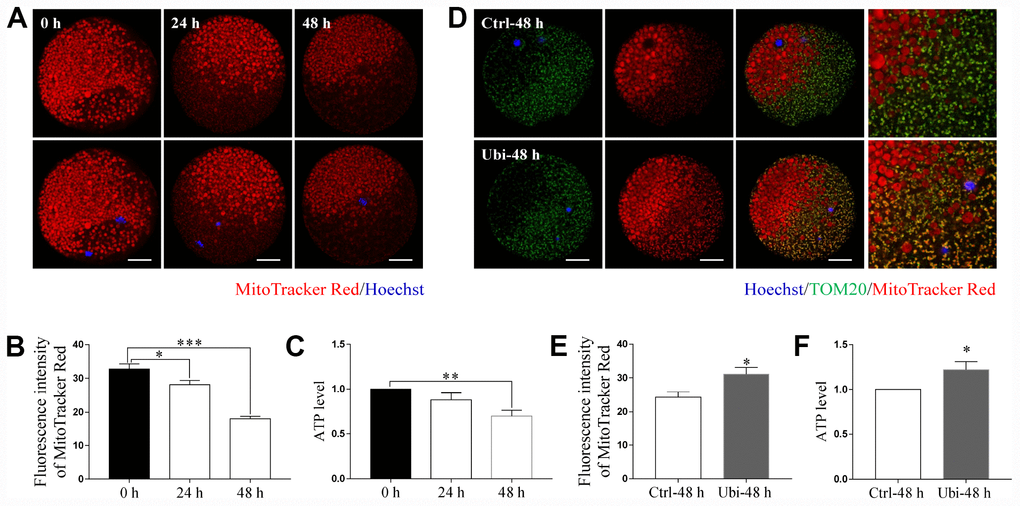 Ubiquinol-10 rescued aging-induced mitochondrial dysfunction. Images (A) and fluorescence intensity (B) of MitoTracker Red in aging 0 h, 24 h, and 48 h oocytes. Scale bars indicate 20 μm. (C) ATP levels of oocytes in aging 0 h, 24 h, and 48 h groups. (D) Colocalization of TOM20 and MitoTracker Red in Ctrl-48 h and Ubi-48 h oocytes. Scale bars indicate 20 μm. (E) Fluorescence intensity of MitoTracker Red in Ctrl-48 h and Ubi-48 h oocytes. (F) ATP levels in Ctrl-48 h and Ubi-48 h oocytes. *p 