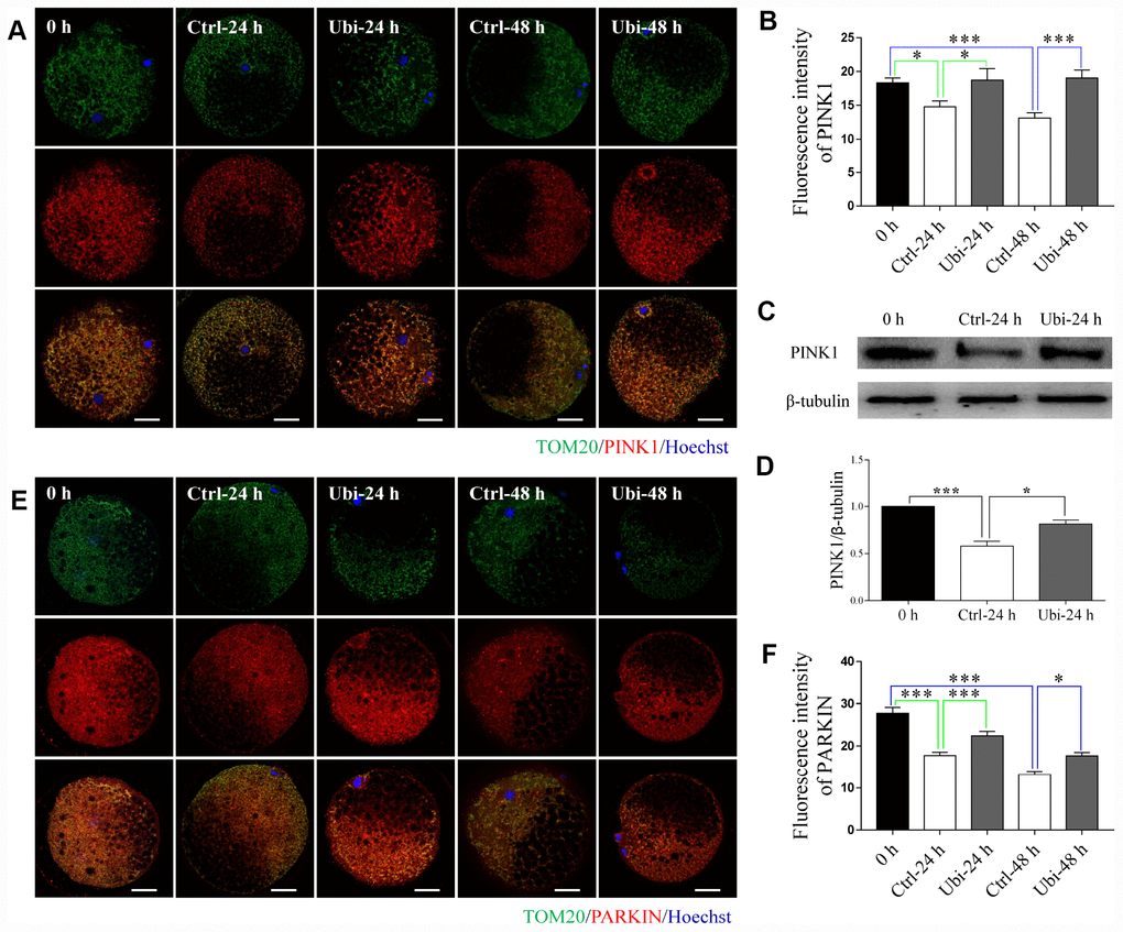Ubiquinol-10 rescued aging-induced compromise of mitophagy. Immunofluorescence images (A) and relative fluorescence intensity (B) showing PINK1 expression in 0 h, Ctrl-24 h, Ubi-24 h, Ctrl-48 h, and Ubi-48 h oocytes. Scale bars indicate 20 μm. Protein levels of PINK1 (C and D) in 0 h, Ctrl-24 h, and Ubi-24 h oocytes were confirmed by western blotting. Immunofluorescence images (E) and relative fluorescence intensity (F) showing PARKIN expression in 0 h, Ctrl-24 h, Ubi-24 h, Ctrl-48 h, and Ubi-48 h oocytes. Scale bars indicate 20 μm.*p 