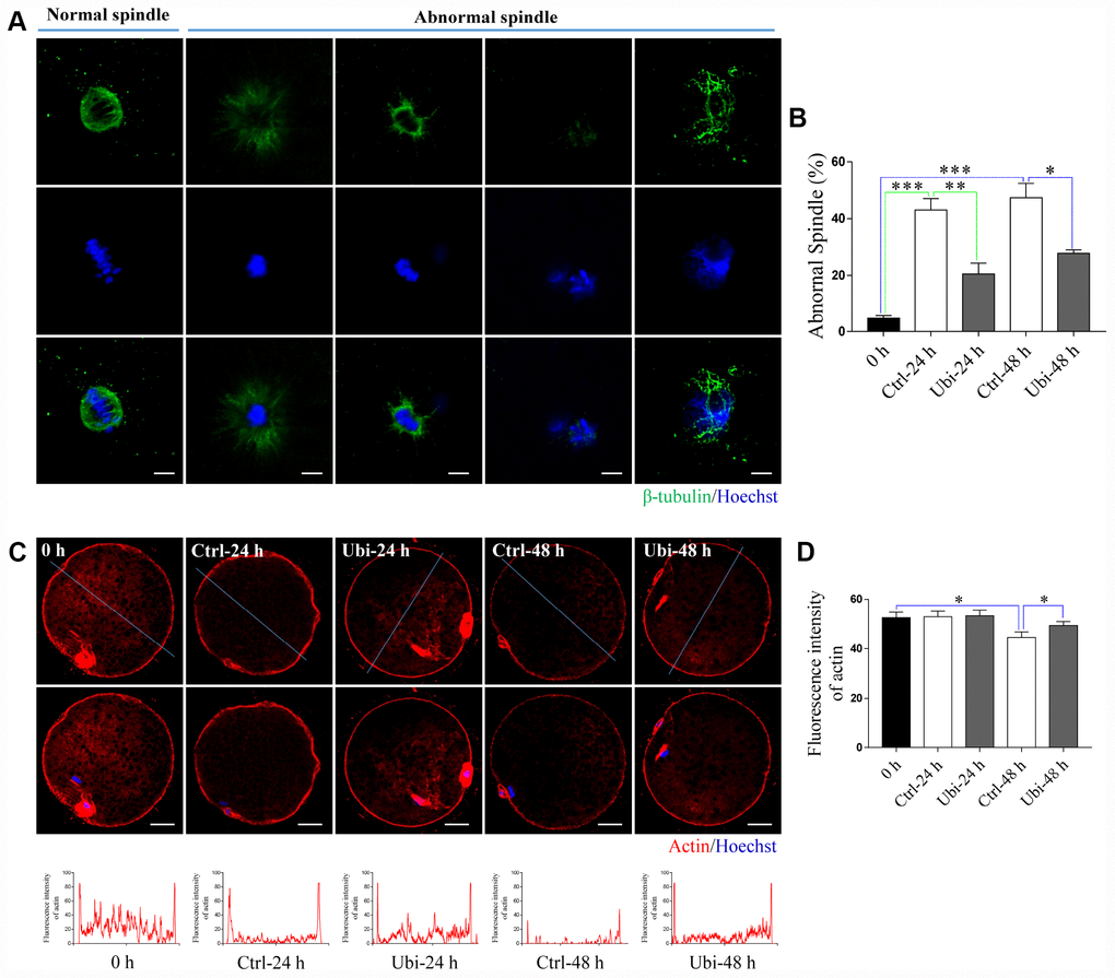 Ubiquinol-10 rescued aging-induced cytoskeleton impairment. (A) Representative confocal images of normal and abnormal spindles. Scale bars indicate 4 μm. (B) The ratio of abnormal spindle in 0 h, Ctrl-24 h, Ubi-24 h, Ctrl-48 h, and Ubi-48 h groups. Representative confocal images (C) and fluorescence intensity (D) of actin in 0 h, Ctrl-24h, Ubi-24 h, Ctrl-48 h, and Ubi-48 h groups. Scale bars indicate 20 μm. *p 