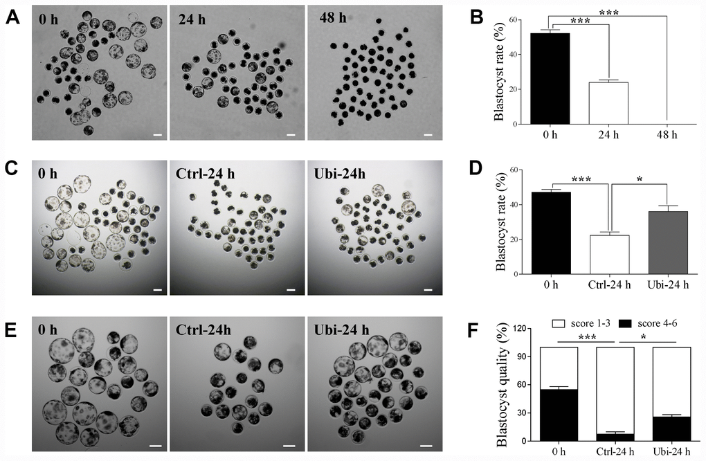 Ubiquinol-10 rescued aging-induced compromise of embryo development. The D6 embryo morphologies (A), blastocyst rate (B) in aging 0 h, 24 h, and 48 h groups. Scale bars indicate 100 μm. The D6 embryo morphologies (C) and blastocyst rate (D) in 0 h, Ctrl-24 h, and Ubi-24 h groups. Scale bars indicate 100 μm. (E) D6 blastocyst images in 0 h, Ctrl-24 h, and Ubi-24 h groups. (F) Blastocysts were graded on a scale from 1 to 6, as illustrated. Blastocyst quality was examined in 0 h, Ctrl-24 h, and Ubi-24 h groups. *p 