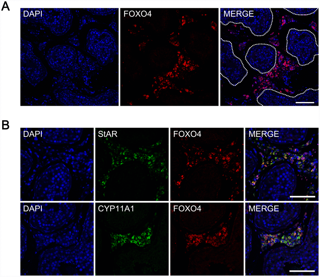 Expression of FOXO4 in human testes detected by immunofluorescent staining. (A) FOXO4 was expressed in the interstitial or peritubular cells of human testes, but not within the seminiferous tubules. (B) FOXO4+ cells expressing the Leydig cell markers StAR and CYP11A1. Scale bar: 100 μm.
