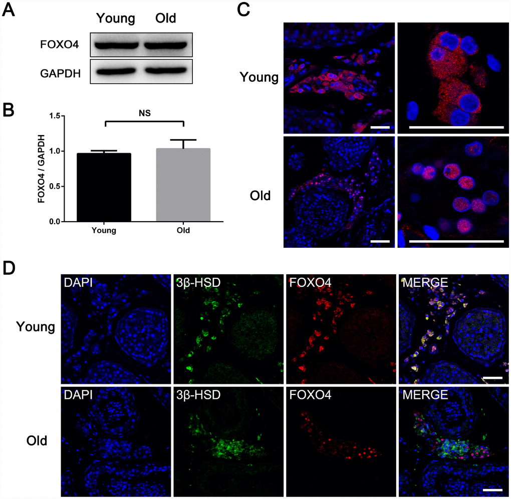 Differences between testicular FOXO4 expression in young ( (A, B) Western blotting revealing no significant difference in FOXO4 protein levels between young and old men (n=6). (C) Immunofluorescent staining showing that FOXO4 localizes predominantly in the cytoplasm of Leydig cells in young men, but in the nucleus in old men. Scale bar: 40 μm. (D) Immunofluorescent staining of FOXO4 and the rate-limiting testosterone synthetic enzyme 3β-HSD showing that nuclear-FOXO4+ Leydig cells express less 3β-HSD than nuclear-FOXO4- Leydig cells in testes from the elderly. Scale bar: 50 μm. Data depict the mean ± SD. NS, nonsignificant, *P