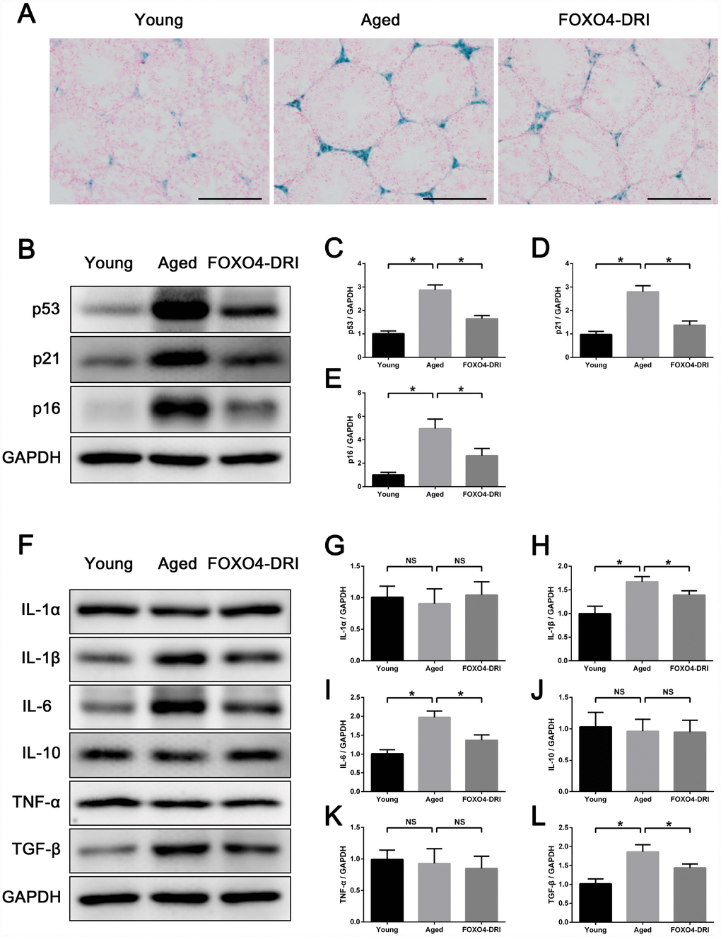 FOXO4-DRI improves the testicular microenvironment in naturally aged mice. (A) SA-β-gal assay showing that FOXO4-DRI treatment decreases SA-β-gal activity in the testicular interstitium in aged mice. Scale bar: 200 μm. (B–E) Western blots revealing FOXO4-DRI decreases levels of the senescence-associated proteins p53, p21 and p16 in testes of aged mice. (F–L) Western blots revealing that FOXO4-DRI decreases levels of the SASP factors IL-1β, IL-6 and TGF-β in testes of aged mice, but has no effect on testicular levels of IL-1α, IL-10 and TNF-α. Data depict the mean ± SD. n=6. *P