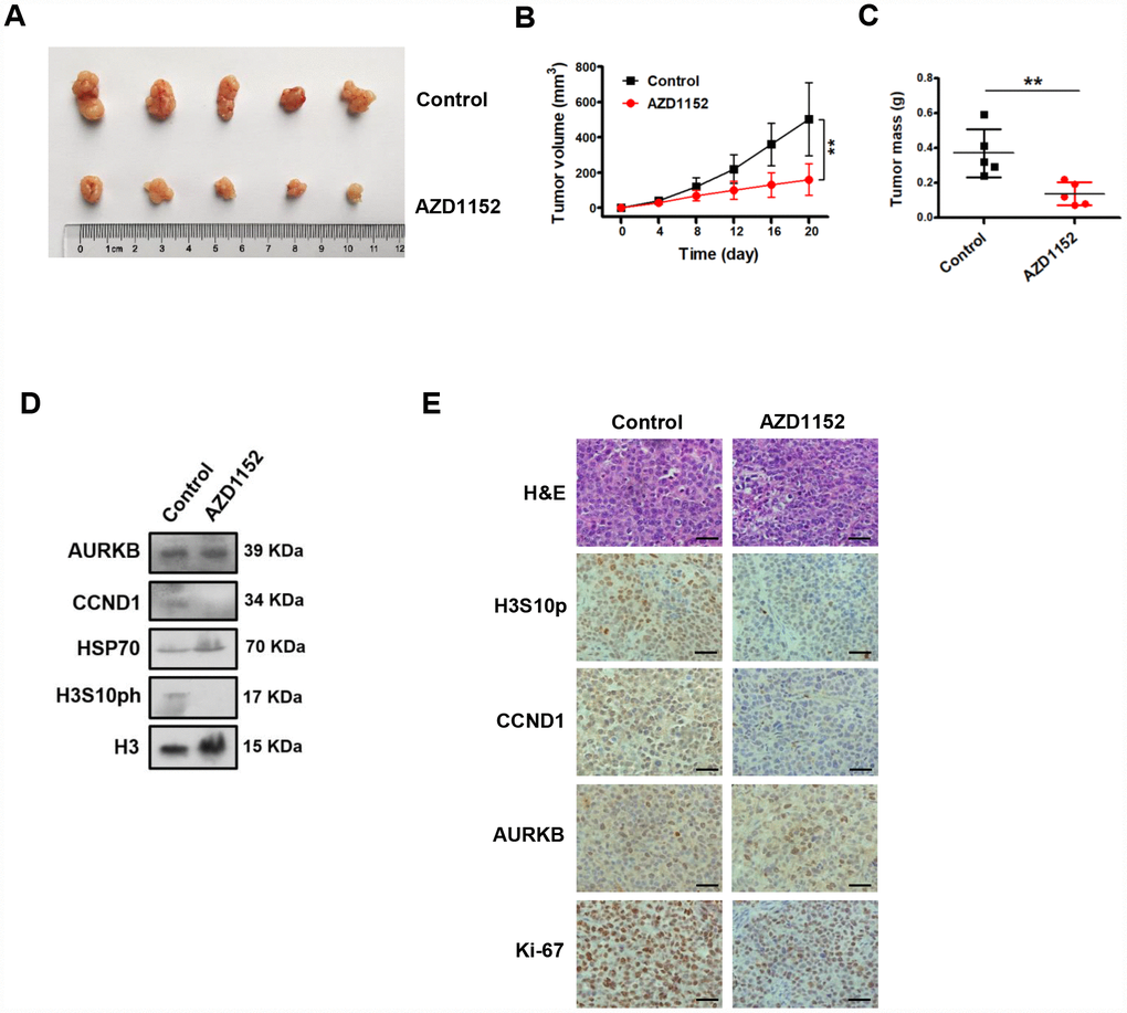 Inhibition of AURKB kinase activity represses the expression of CCND1 and decreases gastric cancer growth in vivo. (A) Photograph of xenograft tumors excised from mice treated with AZD1152 (25 mg/kg). (B) Tumor volumes were examined on the indicated days. Data are presented as the means ± SDs; **, P C) Tumor mass of xenograft tumors excised from mice treated with AZD1152 (25 mg/kg). (D) Western blot analysis of AURKB, CCND1 and H3S10ph expression in xenograft tumors treated with AZD1152 (25 mg/kg). HSP70 and histone H3 were used as the endogenous controls. (E) Hematoxylin and eosin (H&E) staining and IHC staining of AURKB, CCND1, H3S10ph and Ki-67 in xenograft tumors excised from mice treated with AZD1152 (25 mg/kg) and control.