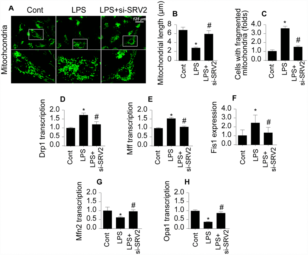 SRV2 triggers mitochondrial fission in cardiomyocytes. (A–C) Average mitochondrial length was measured and proportion of fragmented mitochondria was evaluated in an immunofluorescence assay after cardiomyocytes were transfected with siRNA against SRV2. (D–F) RNA was isolated from LPS-treated cardiomyocytes and qPCR was performed to analyze Drp1, Fis1, and Mff transcript levels. (G–H) RNA was isolated from LPS-treated cardiomyocytes and qPCR was performed to analyze Mfn2 and Opa1 transcript levels. *p