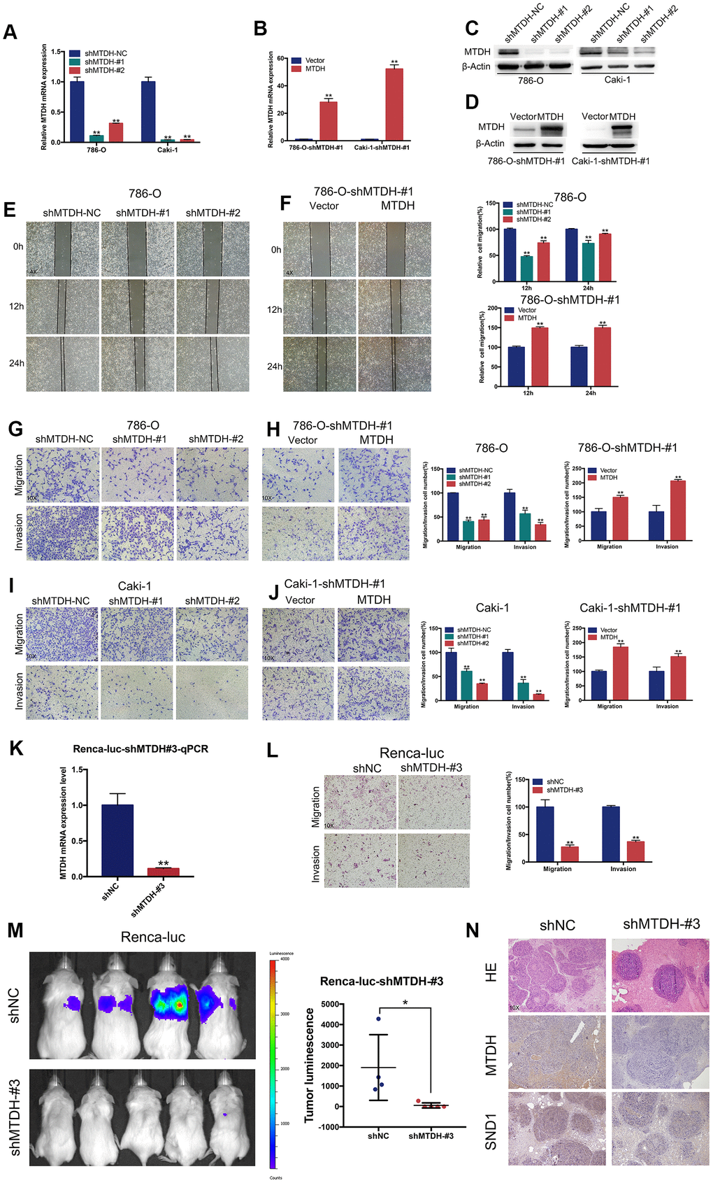 MTDH promotes cell migration and invasion of ccRCC cells. (A–D) RT-qPCR and western blot analyses of ccRCC cells infected with a lentivirus-mediated MTDH-overexpressing vector or MTDH shRNAs. (E–F) Wound-healing assay. Representative images of wound-induced cell migration by the 786-O-shMTDH, 786-O-#1-MTDH and control cells(4x). (G–J) Representative images of transwell migration and invasion assay of MTDH-knockdown cells and MTDH-overexpressed cells(10x). (K) RT-qPCR analyses of Renca-luc cells infected with a lentivirus-mediated MTDH shRNAs. (L) Representative images of transwell migration and invasion assay of Renca-luc-shMTDH#3(10x). (M) Tail vein-injected Renca-luc metastasis model. Representative IVIS images of mice injected mouse MTDH-silenced or control cells and analysis of tumor luminescence representing lung metastasis measured on day 21. Five mice per group (Renca-luc-shNC ccRCC cells failed in tail vein injection in one mice.) (N) Lung metastasis was confirmed by H&E and IHC- MTDH staining(10x).