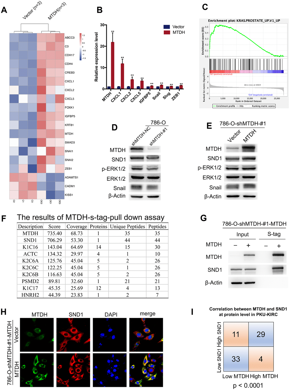 MTDH promotes metastasis by activating ERK signaling and EMT. (A) Heatmap representation of differentially expressed genes identified by RNA-Seq between 786-O-shMTDH-#1-MTDH cells (n = 3) and 786-O-shMTDH-#1-vector Control cells (n = 3). (B) Validation of differentially expressed genes by RT-qPCR. Comparison of mRNA expression of genes in pathways of cancer (CXCL1/2/5 and IGFBP5) and genes in EMT-related pathway (Snail, Slug and ZEB1) between 786-O—shMTDH-#1-MTDH cells and 786-O—shMTDH-#1-vector Control cells. All data are shown as means ± SD. (C) Based on our own RNA sequencing data, genes influenced by MTDH overexpression were mostly enriched in pathways involved with KRAS signaling using Gene Set Enrichment Analysis (GSEA) pathway analysis. (D) Silencing MTDH reduced the protein expression of p-ERK1/2, Snail and SND1 in ccRCC cells. (E) Overexpressing MTDH increased the protein expression of p-ERK1/2, Snail and SND1 in ccRCC cells. (F) The result of mass spectrometry analysis of s-tag pull down assay confirm the interaction between MTDH and SND1 at the protein level. (G) MTDH and SND1 were co-localized, mainly in the cytoplasm. (H) The result of immunoprecipitation revealed that MTDH binds to SND1 at the protein level. (I) The correlation of MTDH and SND1in PKU-KIRC dataset was statistically analyzed (P