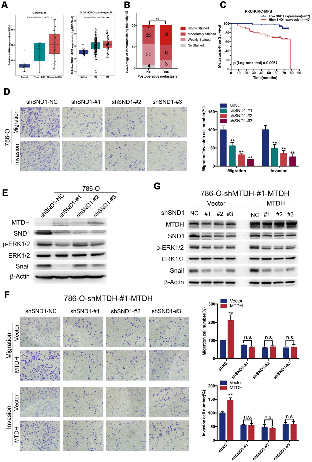 MTDH promotes metastasis largely by enhancing SND1-mediated EMT and ERK signaling. (A) SND1 mRNA expression was increased in ccRCC tissues in both TCGA dataset and GSE105288, especially in metastatic ccRCC. (B) Compared to those without postsurgical metastasis, ccRCC patients with postsurgical metastasis had higher SND1 protein expression levels in PKU-KIRC dataset. (C) The ccRCC patients with high SND1 protein expression levels had shorter MFS than those with lower SND1 expression levels (p = 0.0061). (D) Migration and invasive capabilities were attenuated in 786-O-SND1-knockdown cells(20x). (E) Silencing SND1 reduced the protein expression of p-ERK1/2, Snail in 786-O cells. (F) knockdown of SND1 could abolish promoting migration and invasive capabilities of ccRCC cells induced by overexpressing MTDH(20x). (G) Silencing SND1 could attenuate increased expression of snail and p-ERK protein induced by overexpressing MTDH.