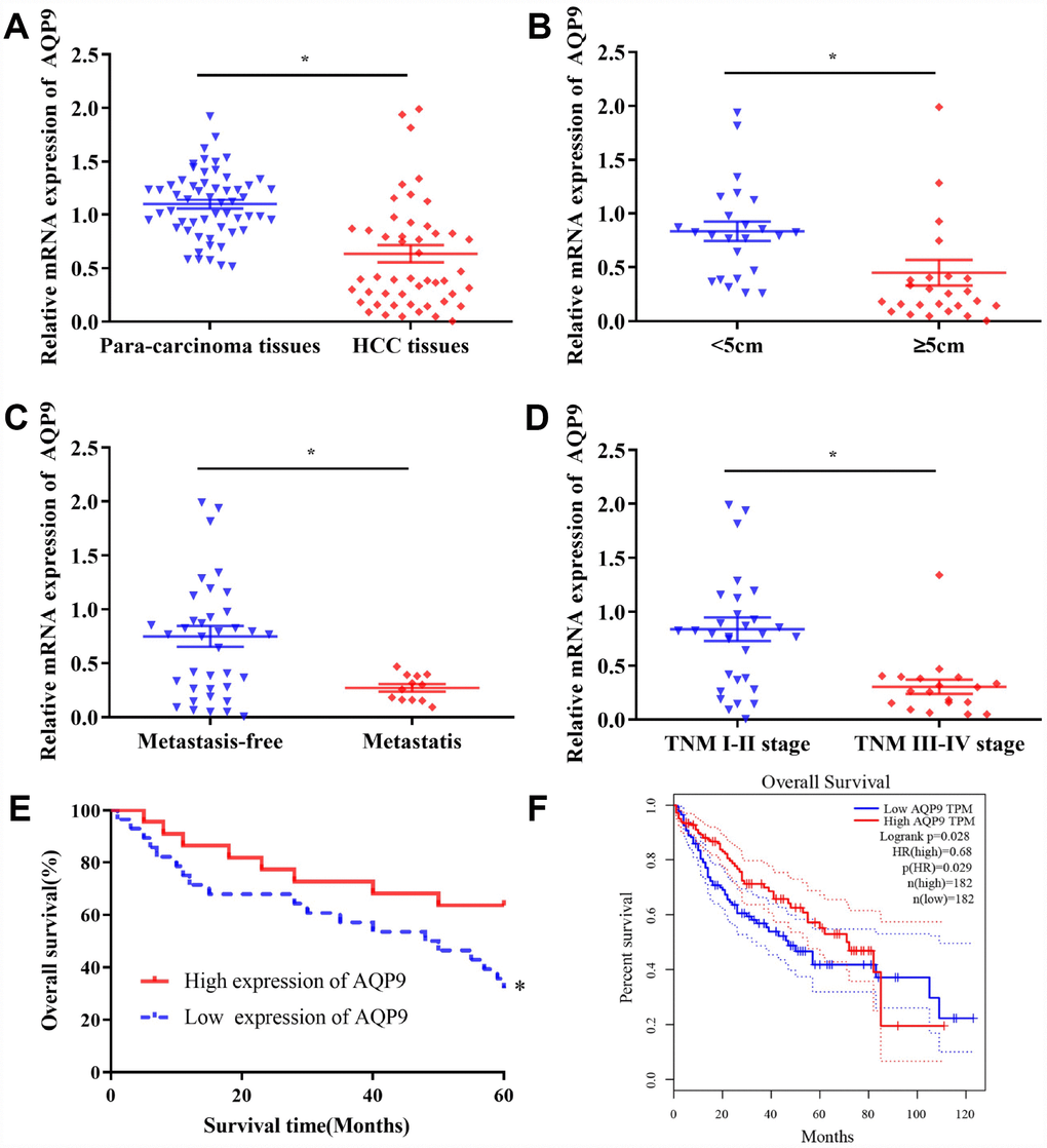 The levels of AQP9 in HCC tissues were associated with the prognosis of patients. (A) The expression of AQP9 was evaluated in HCC and matched para-carcinoma samples by RT-qPCR. The levels of AQP9 were examined in HCC tissues with various tumor diameter (B) lymph node metastasis (C) and different TNM stages (D). Survival rate of 50 HCC patients with different AQP9 expression levels (E) and those in the GEPIA database (F); 182 cases with high-/low-expression were analyzed. The results were represented as mean ± SD. P