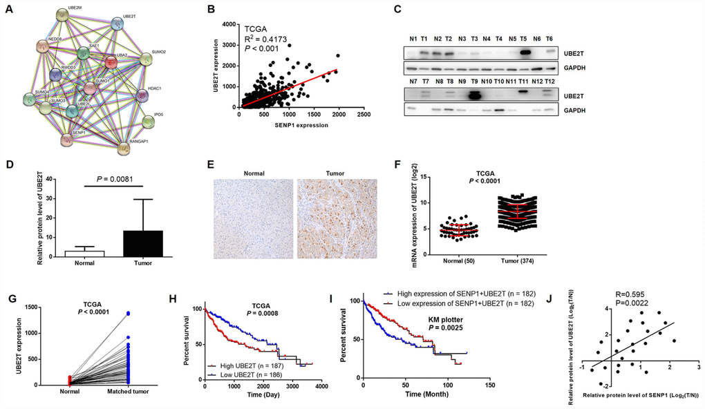 UBE2T is overexpressed in HCC tissues and cell lines. (A) SENP1-related interaction network was constructed based on String database. (B) Correlation analysis of SENP1 and UBE2T expression was performed based on gene expression profiling data of TCGA. (C) The protein levels of UBE2T in adjacent normal tissues and tumor tissues were examined by western blot. (D) The average relative protein levels of UBE2T in adjacent normal tissues and tumor tissues obtained from gray analysis of Western blot results. (E) The expression of UBE2T in adjacent normal tissues and tumor tissues was determined by immunohistochemical staining. (F, G) UBE2T expression in TCGA RNAseq database. (H, I) The association between UBE2T expression or SENP1+UBE2T expression and survival rate in TCGA database or KM plotter dataset. (J) Expression of SENP1 and UBE2T were positively related in HCC clinical samples. The data were analyzed with Pearson correlation by GraphPad prism 6.0. The representative images were selected from at least three independent experiments.