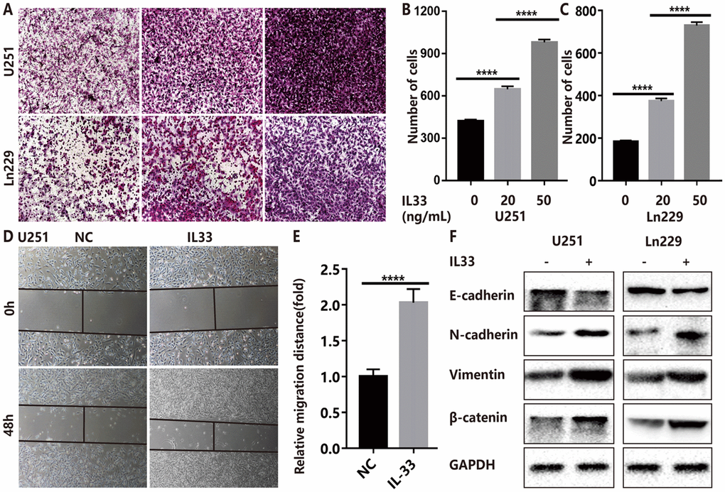 IL-33 promotes glioma cell invasion, migration and mesenchymal transition. (A) Effects of IL-33 on glioma cells invasion. Glioma cell lines U251 and Ln229 were subject to transwell assay for 24 hours. IL-33 was added in different concentrations. (B, C) The number of cells moved through the chambers were counted for per field of view and analyzed. Each column represents three independent experiments; Results are expressed as the mean±SD; n=3; ***, P D–E) IL-33 promotes the migration of glioma cells U251 by wound healing assay. The tumor cells moving distance was detected and divided by control group as relative migration distance for statistical analysis. Results are expressed as the mean±SD; n=3; ****, P F) The levels of core epithelial marker E-cadherin and mesenchymal markers including vimentin, N-cadherin and β-catenin were detected by Western blotting.