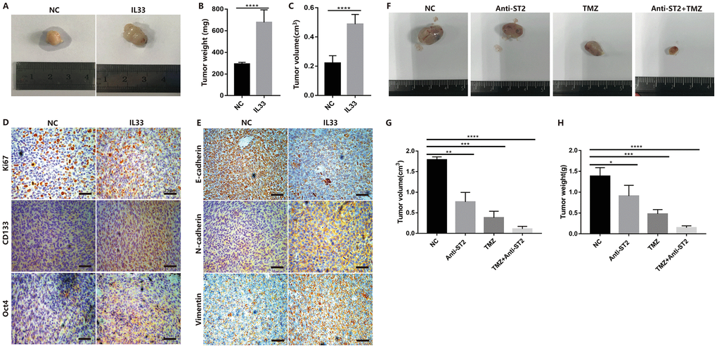IL-33 promotes glioma tumorigenesis, EMT and stemness in vivo. (A) Glioma cells (Ln229) were subcutaneously injected into nude BALB/c mice in the presence or absence of 1ug/ml IL-33 and allowed to grow until tumors formed (4 weeks). (B and C) The tumor volume and tumor weight were monitored at 4 weeks after injection. Results are expressed as the mean of tumor volume ± SD; n=5; ****, PD and E) primary glioma sections form mouse models were stained with proliferative maker Ki67, EMT related antibodies (E-cadherin, N-cadherin and Vimentin) and core stem genes (CD133 and Oct4) for IHC assay. (F) Glioma cells were subcutaneously transplanted into back flanks of NSG mice. After transplanted for 3 weeks, PBS, Anti-ST2, TMZ and Anti-ST2+TMZ were administered intraperitoneally (i.p.) into mice for consecutive 7 days. All NSG mice were killed in the sixth week. (G and H) tumor volume and weight were monitored and analyzed. Results are expressed as the mean of tumor volume ± SD; n=5; *, P 