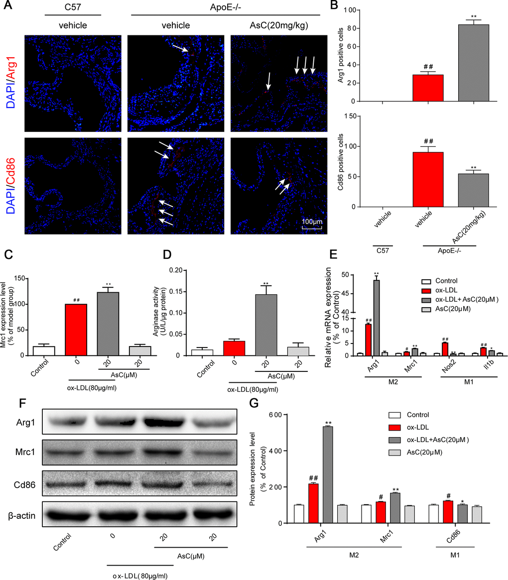 AsC polarized macrophages to an M2-like phenotype. All mice were fed a HFD in the presence or absence of AsC (20 mg·kg-1·day-1, i.g.) for 4 weeks. In the in vitro assay, RAW264.7 cells were pretreated with AsC (20 μM) for 12 h, and then exposed to ox-LDL for another 24 h. (A) Dual immunofluorescence staining for Arg1 (red) or Cd86 (red) and DAPI (blue) in lesions in the aortic root. (B) Quantification of the relative fluorescence intensity. (C) The Mrc1 expression level in ox-LDL-treated macrophages, as determined by flow cytometry. (D) Arginase activity was measured as described in the Methods section. (E) mRNA levels of Arg1, Mrc1, Nos2 and Il1b in macrophages, as quantified by real-time PCR. (F) Representative photographs of Mrc1, Cd86 and Arg1 expression in ox-LDL-treated macrophages, as evaluated by western blot analysis. (G) Statistical results of Mrc1, Cd86 and Arg1 expression levels compared with those in the control group. The data are presented as the means ± SDs (n = 5). #P ##P vs. the control group, **P vs. the model group.