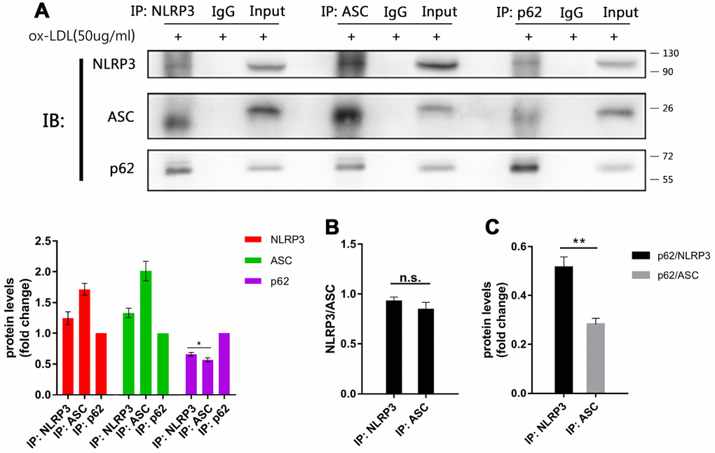 The main target of p62 is more likely to be NLRP3. (A above) The immunoblot analysis of the NLRP3, ASC and p62 immunoprecipitates of cell lysates obtained from Mφ, which had been stimulated with ox-LDLs (50 ug/ml) for 24 hours. (A below) The densitometric analysis of the NLRP3, ASC and p62 signal, which were normalized to the corresponding signals in the p62 immunoprecipitates. (B) The densitometric analysis of the ratios of NLRP3/ASC obtained from the NLRP3 immunoprecipitates and the ASC immunoprecipitates. (C) The densitometric analysis of p62 signal detected in the NLRP3 immunoprecipitates and the ASC immunoprecipitates, and normalized to the corresponding NLRP3 and ASC signal respectively. The data are presented as mean ± SD (n=3); * denotes the statistical significance by one-way ANOVA with post hoc Dunnett’s multiple comparisons test (A) or by t-test (B and C). *PPP