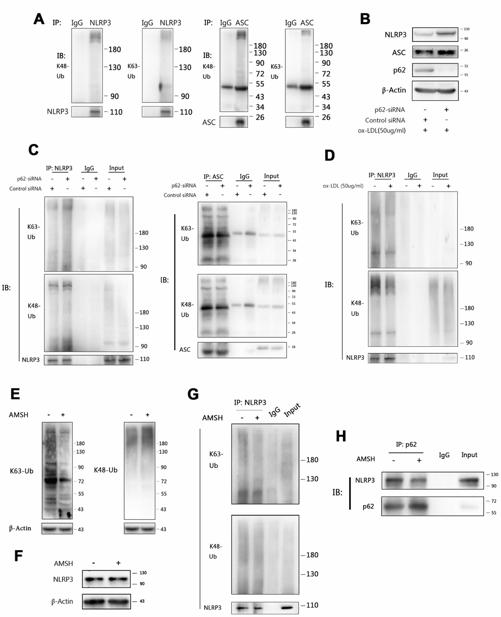 P62 binds to NLRP3 via the K63 polyubiquitin chains. (A) The immunoblot analysis of NLRP3 and ASC immunoprecipitates of Mφ stimulated with ox-LDLs (50 ug/ml) for 24 hours. (B) The immunoblot analysis of the total lysates of Mφ transfected with control siRNA or p62-siRNA for 24 hours, and subsequently stimulated with ox-LDLs (50 ug/ml) for another 24 hours. (C) The immunoblot analysis of NLRP3 (left) and ASC (right) immunoprecipitates of Mφ treated as described in (B). (D) The immunoblot analysis of NLRP3 immunoprecipitates of Mφ treated with or without ox-LDL (50 ug/ml) for 24 hours. (E) The detection for K63 (left) and K48 (right) polyubiquitin chains in the total foam-cell lysates pretreated with or without AMSH by immunoblotting. Prior to immunoblotting, 50 ul of ox-LDL stimulated Mφ lysates were administered with or without 1 ul of AMSH (AMSH concentration: 500 nM), and incubated at 37°C for 30 minutes. (F) The immunoblot analysis of NLRP3 and β-Actin in the total foam-cell lysates pretreated with or without AMSH (500 nM), as described in (E). (G) The NLRP3 immunoprecipitates obtained from ox-LDL stimulated Mφ lysates were treated with or without AMSH (500 nM), as described in (E), and subsequently subjected to immunoblotting. (H) The p62 immunoprecipitates obtained from foam-cell lysates were treated with or without AMSH (500 nM), as described in (E), and subsequently subjected to immunoblotting. All experiments were independently repeated for at least three times.